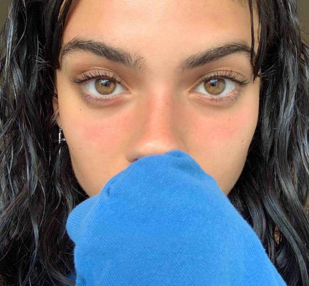 ケルシーのインスタグラム：「hi it’s me again stopping by to say i’m v sunburnt」