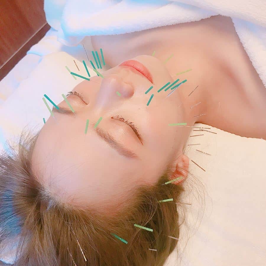 のインスタグラム：「. . (2枚目は術後です🌸) , もはや小顔術マニアみたいに なってる牧野ですが、、、 新しく素敵な小顔術見つけてきました！🙆‍♀️ . 麻布十番にある @azabuharieq 様です👏🏻✨ #美容鍼 なんだけど、リフトアップさせながら 刺してくれる鍼で術後のスッキリ度が 本当にすごいから伝えたくて 動画に撮りました💗 この日は身体もしてもらって 身体の疲れもほぐしていただきました🙇‍♀️ . 綺麗な女性鍼灸師さんがとっても丁寧に 施術してくれるのに感激したの、ほんとに！ . このインスタを見てくれてる 小顔になりたくてしかたないみなさん 『牧野桃美のインスタを見た！』と 言って予約すると1000円OFFして もらえるみたいなので、 ぜひぜひ、使ってみてね💡💕 . . . . . . . . #ハリーク#小顔#鍼灸#お灸#美容好きな人と繋がりたい#美肌#美容マニア#麻布十番#美容サロン#instabeauty#リフトアップ#ほうれい線#たるみ」