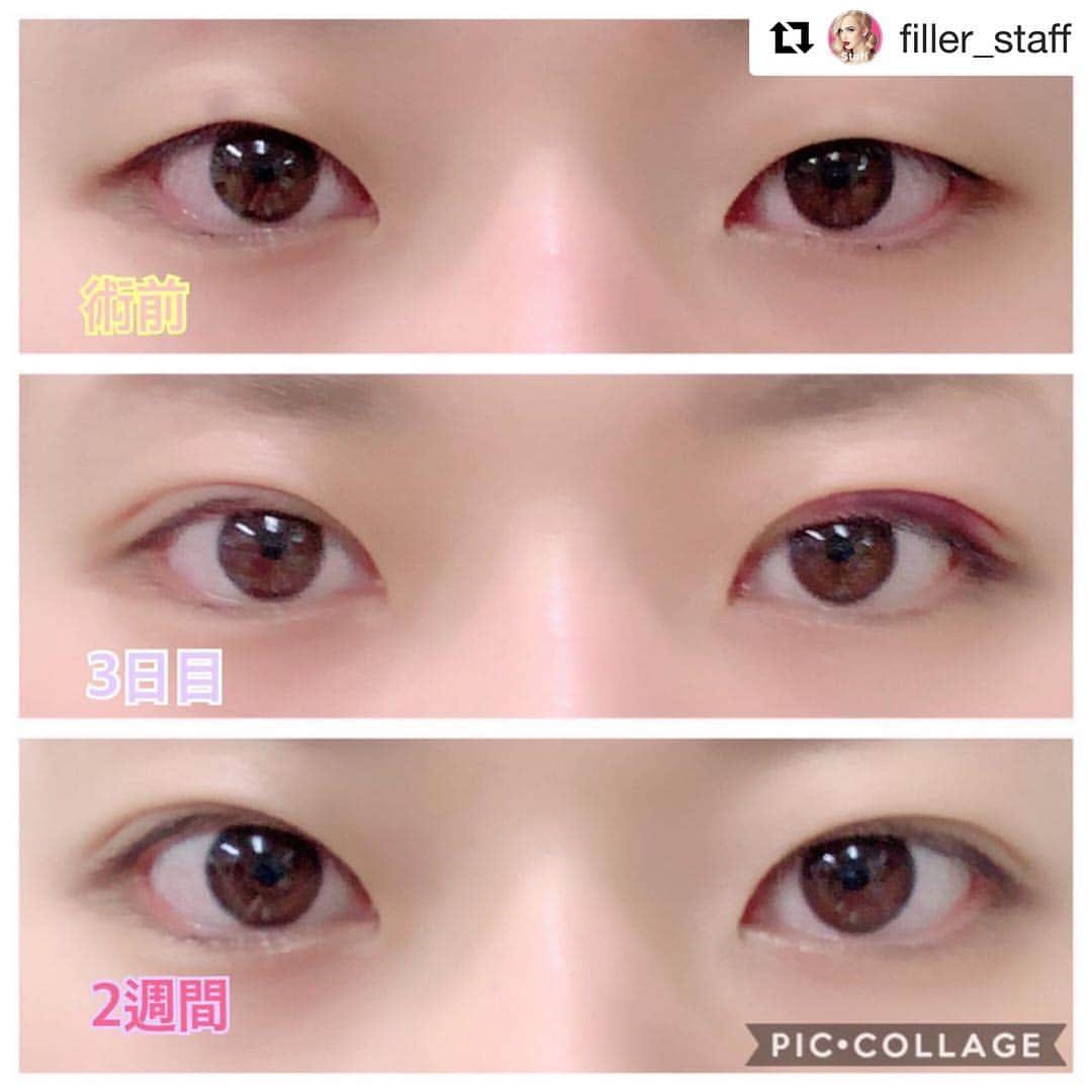 恵比寿フィラークリニックのインスタグラム
