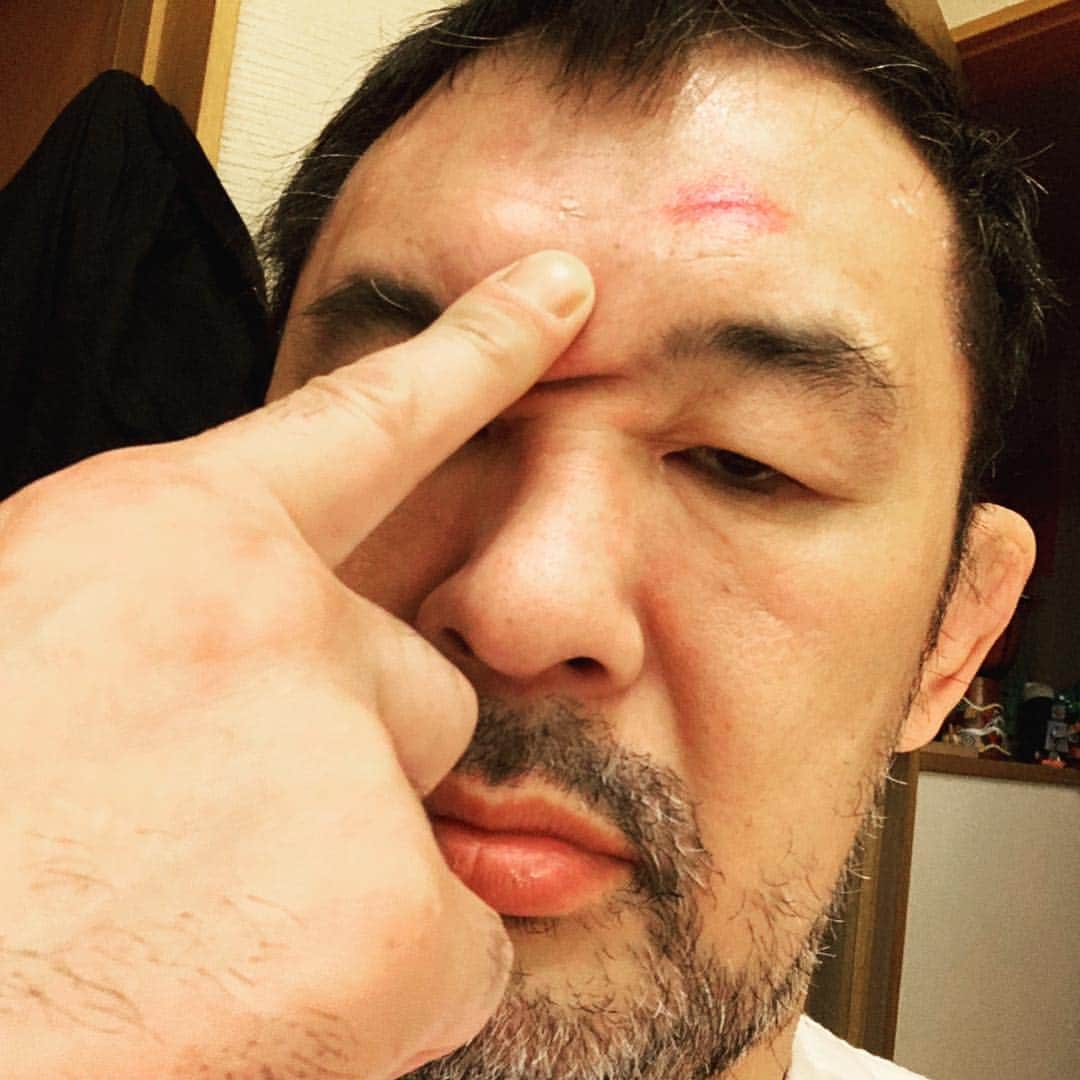 のインスタグラム：「. 【Bump???】 . 飲んでタクシーを降りる時に転んじゃいました😅 格闘技の受身かんけーねー！ 皆さんもお気をつけください🙇‍♂️ . #sakuraba #bump #転ぶ #アザ #受身」