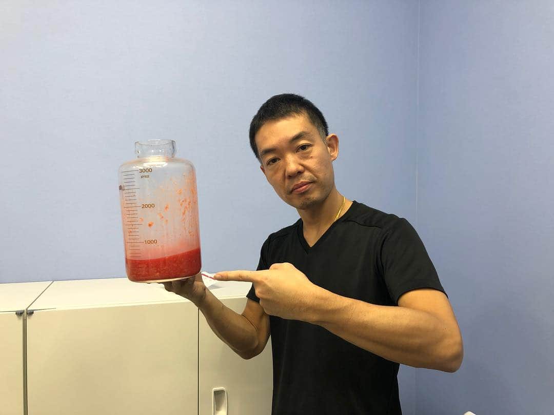 のインスタグラム：「#岐阜 県から患者様にお越しいただきました！今日も手術に、経過観察に、会議にと大変充実した一日になりました！患者様、スタッフさん、ありがとうございました！！ ٩(๑❛ᴗ❛๑)۶ ぜひ竹田先生の オフィシャルホームページも ご覧ください！！ 竹田啓介 オフィシャル  と検索するか、以下のアドレスへ！  http://shiboukyuuin-takeda.com/#  #湘南美容外科 #脂肪吸引 #豊胸 #根こそぎ #竹田 #相川佳之 #美容外科 #美容整形 #ダイエット #sbc #liposuction #ベイザー #脱毛 #二重 #ミラドライ #新橋 #新橋銀座口 #銀座 #コリドー街 (๑･̑◡･̑๑)」