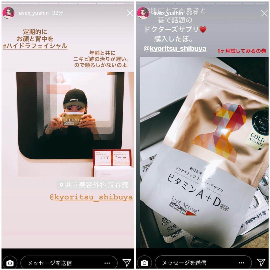 共立美容外科・歯科・皮膚科さんのインスタグラム写真 - (共立美容外科・歯科・皮膚科Instagram)「ありがとうございました🤗 またお待ちしてます⭐️✨ @avex_yushin ・ #共立美容外科 #ハイドラフェイシャル #美肌 #美白 #毛穴洗浄 #ニキビ #ザラつき #たまご肌 #つるつる #リブアクティブドクターズサプリ #ビタミンA #赤ちゃん肌 #サプリ #ビタミン #ゆしん」3月15日 19時27分 - kyoritsu_biyo