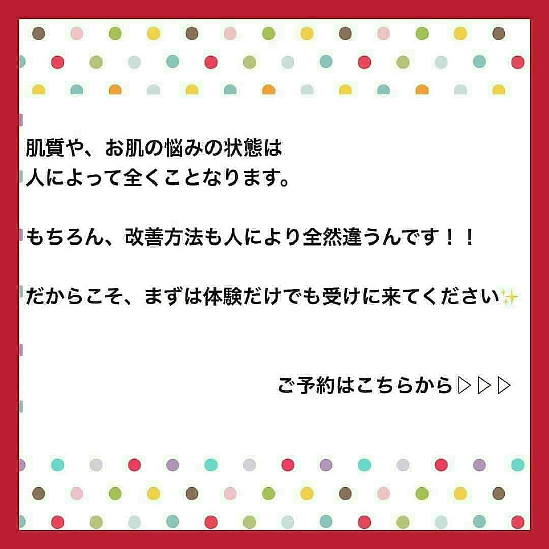 肌質改善専門サロン~Accueil~さんのインスタグラム写真 - (肌質改善専門サロン~Accueil~Instagram)「💙💚❤️3/16空きあり💛💜❤ * * 【ご予約はこちら👇🏼】 🌟🌟 @accueil_ikebukuro 🌟🌟 . ※今だけ期間限定クーポンあり . . . 肌荒れの原因は人それぞれなのにも関わらず、 周りの人と同じケアをしていませんか💦？？ * ❌お薬を塗っても飲んでも変わらない、、 ❌食事を気にしても肌が荒れる、、 ❌スキンケアを変えてもイマイチ、、 ❌何かしら常にトラブルが肌にある、、 ❌ニキビが繰り返しできる、、 * * そのお悩み解決できちゃいます😌✨ Accueilは、どのサロンに行っても良くならなかったお客さまたちや、 どの皮膚科に行っても変化がなかったお客さまたちが多く訪れてくださっています🙌💕* * * * もう悩まない！！！ 繰り返さないところまでしっかりと根本改善していきます☺️ そろそろ肌荒れから卒業しませんか？ * →→→初回体験はこちらから👉🏼 @accueil_ikebukuro * * * * Accueilでのお手当は、、 * 機械は一切使いません🙅‍♀️❌ 使うお化粧品は １００％天然の「ミネルヴァ化粧品」🌲🍃 ニキビの炎症がある方・アトピーの方でも 安心して受けていただける事ができる お肌にとても優しいエステです♡♡ * * お肌のお悩みなら、何でもお任せください😊💕 * * ■「インスタ見ました！」 で、 初回体験￥26,000 →→✨￥５，９８０✨ * * * --------当サロンのご予約方法≫--------- *  1️⃣当サロンのインスタTopのURL ⭐『Hotpepper Beauty』の 「instagram限定クーポン」にてご予約可能♡♡ * * 2️⃣インスタのDMからご予約 （下記項目を記載の上、お問い合わせください♪） * 🔶お名前（フルネーム） * 🔶お電話番号 * 🔶希望日時（第１～第３希望） * 🔶ご希望のメニュー * * 3️⃣お電話でのご予約✨ 　03-6912-5705にお願いします♡ ----------------------------------------- * * @accueil_ikebukuro ✨ #ニキビ #ニキビ跡 #毛穴 #乾燥肌 #ニキビ跡ケア #肌荒れ #ニキビ跡改善 #ニキビ肌改善 #ニキビ治療 #保湿 #毛穴の黒ずみ #毛穴の開き #スキンケア #毛穴吸引 #アトピー女子 #ニキビ皮膚科  #美肌ケア  #ニキビ専門 #肌質改善 #背中ニキビ #アトピー肌 #乾燥 #ニキビケア #毛穴ケア #アトピー治療 #肌悩み #スキンケア難民 #肌トラブル改善 #スキンケア大事 #目指せ美肌」3月15日 22時55分 - accueil_ikebukuro