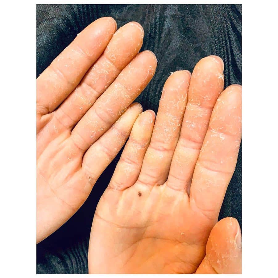 小林由佳さんのインスタグラム写真 - (小林由佳Instagram)「Ojeee😱😱 Looks like my skin of finger get a ROCK withdrawal symptoms🤦🏻‍♀️💭 ・ ・ 日本に帰国して早2週間🇯🇵 トレーニングを始めるも、あたしの指皮はホールドを受け付けたくないらしい。 早くも禁断症状か 指皮ぼっそぼそ😑」3月16日 20時00分 - yuca_tan