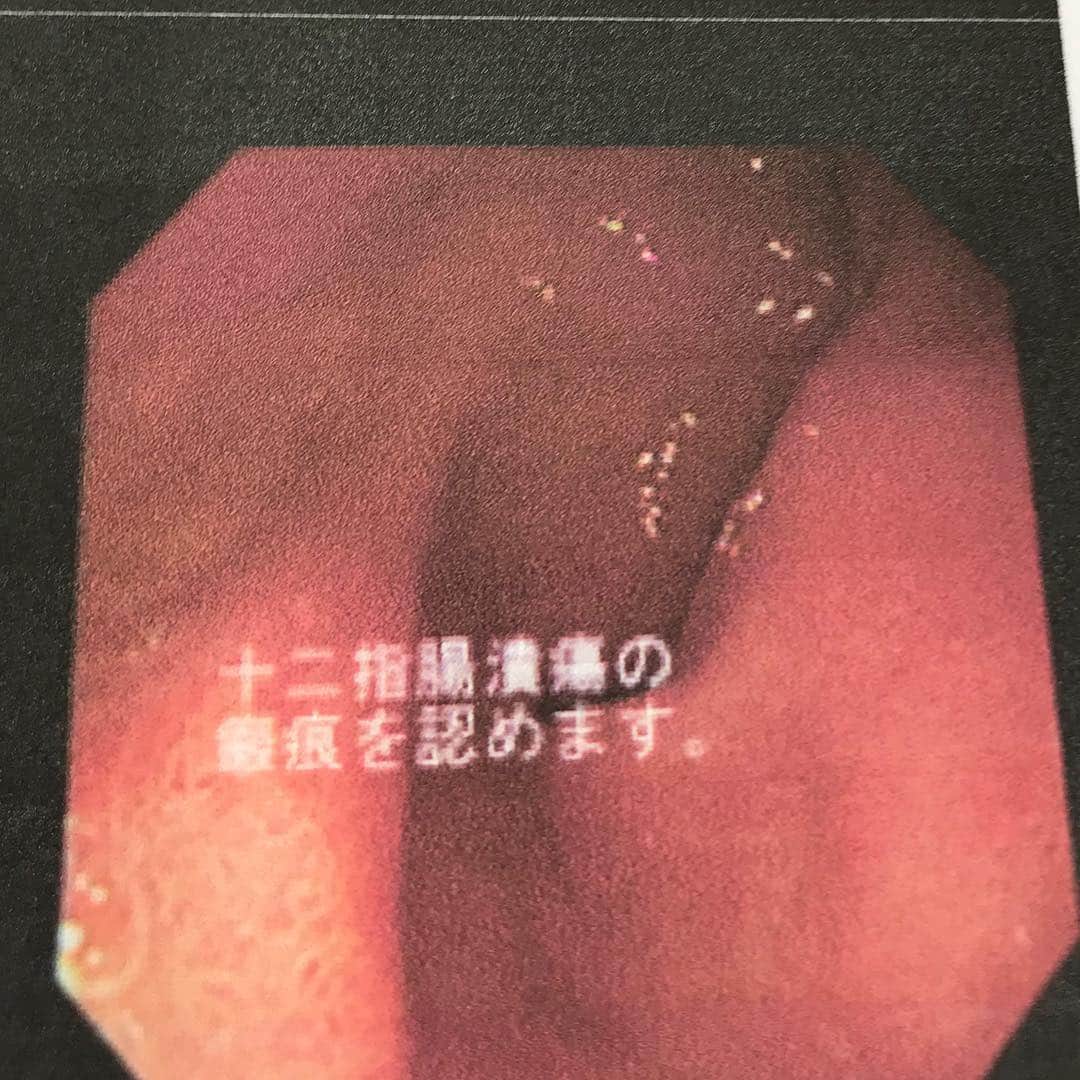 パーティ内山さんのインスタグラム写真 - (パーティ内山Instagram)「#十二指腸潰瘍 #胃炎 #療養中 #パーティ内山」3月16日 23時44分 - ruichanfamily
