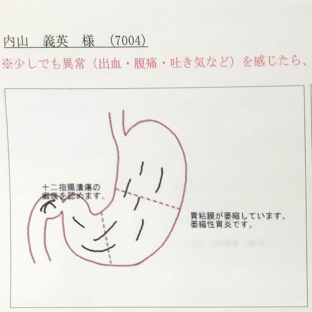 のインスタグラム：「#十二指腸潰瘍 #胃炎 #療養中 #パーティ内山」