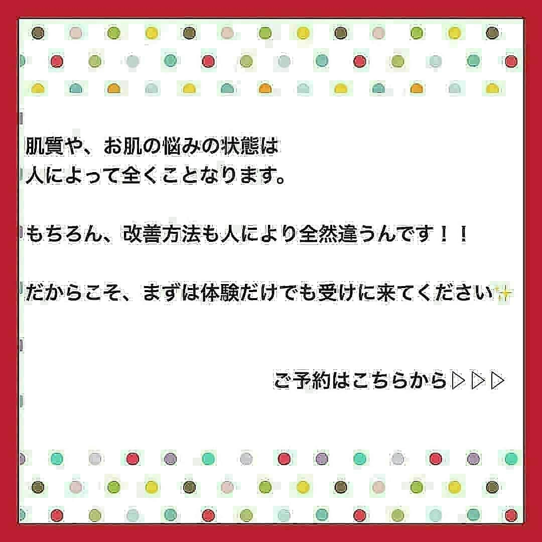 肌質改善専門サロン~Accueil~さんのインスタグラム写真 - (肌質改善専門サロン~Accueil~Instagram)「💙💚💛18日空きあり💛💜❤ * * 【ご予約はこちら👇🏼】 🌟🌟 @accueil_ikebukuro 🌟🌟 . ※今だけ期間限定クーポンあり . . . 肌荒れの原因は人それぞれなのにも関わらず、 周りの人と同じケアをしていませんか💦？？ * ❌お薬を塗っても飲んでも変わらない、、 ❌食事を気にしても肌が荒れる、、 ❌スキンケアを変えてもイマイチ、、 ❌何かしら常にトラブルが肌にある、、 ❌ニキビが繰り返しできる、、 * * そのお悩み解決できちゃいます😌✨ Accueilは、どのサロンに行っても良くならなかったお客さまたちや、 どの皮膚科に行っても変化がなかったお客さまたちが多く訪れてくださっています🙌💕* * * * もう悩まない！！！ 繰り返さないところまでしっかりと根本改善していきます☺️ そろそろ肌荒れから卒業しませんか？ * →→→初回体験はこちらから👉🏼 @accueil_ikebukuro * * * * Accueilでのお手当は、、 * 機械は一切使いません🙅‍♀️❌ 使うお化粧品は １００％天然の「ミネルヴァ化粧品」🌲🍃 ニキビの炎症がある方・アトピーの方でも 安心して受けていただける事ができる お肌にとても優しいエステです♡♡ * * お肌のお悩みなら、何でもお任せください😊💕 * * ■「インスタ見ました！」 で、 初回体験￥26,000 →→✨￥５，９８０✨ * * * --------当サロンのご予約方法≫--------- *  1️⃣当サロンのインスタTopのURL ⭐『Hotpepper Beauty』の 「instagram限定クーポン」にてご予約可能♡♡ * * 2️⃣インスタのDMからご予約 （下記項目を記載の上、お問い合わせください♪） * 🔶お名前（フルネーム） * 🔶お電話番号 * 🔶希望日時（第１～第３希望） * 🔶ご希望のメニュー * * 3️⃣お電話でのご予約✨ 　03-6912-5705にお願いします♡ ----------------------------------------- * * @accueil_ikebukuro ✨ #ニキビ #ニキビ跡 #毛穴 #乾燥肌 #ニキビ跡ケア #肌荒れ #ニキビ跡改善 #ニキビ肌改善 #ニキビ治療 #保湿 #毛穴の黒ずみ #毛穴の開き #スキンケア #毛穴吸引 #アトピー女子 #ニキビ皮膚科  #美肌ケア  #ニキビ専門 #肌質改善 #背中ニキビ #アトピー肌 #乾燥 #ニキビケア #毛穴ケア #アトピー治療 #肌悩み #スキンケア難民 #肌トラブル改善 #スキンケア大事 #目指せ美肌」3月17日 20時15分 - accueil_ikebukuro