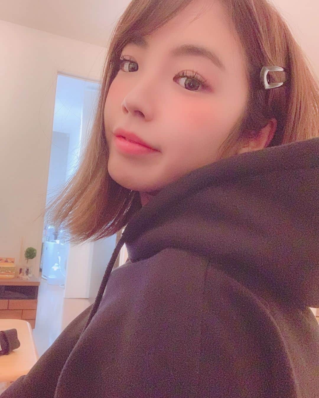 Linaのインスタグラム：「明日からまた頑張ろう🤧🥺 花粉症は突然治ることはないのでしょうか😷？ 目耳喉鼻肌がもう全部痒いいい  @dr.y.yumi @sbeautyclinic  #エスビューティークリニック #sbeautyclinic #渋谷美容クリニック #レーザー治療 #美容 #医療痩身 #アンチエイジング #レーザートーニング #美肌」