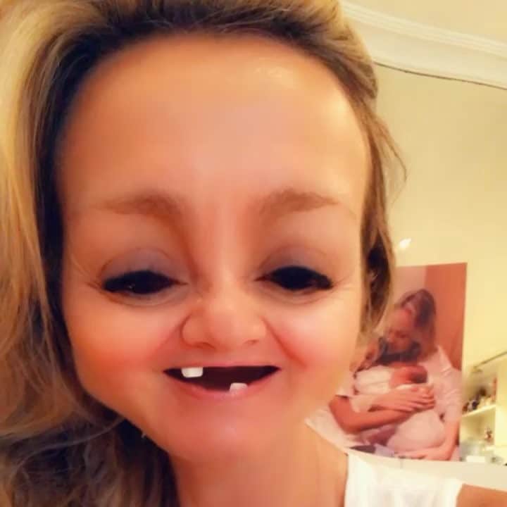 Eliana Michaelichin Bezerraのインスタグラム：「Feliz dia meus amores!!!❤️❤️❤️ #harmonizacaofacial #sqn」