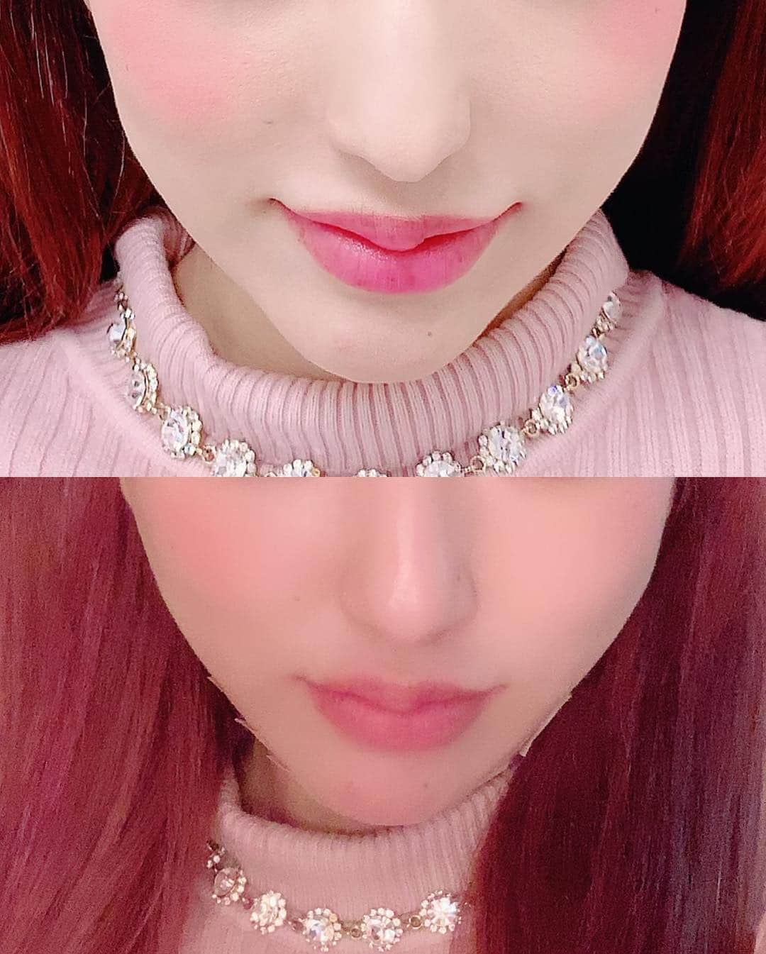 桜咲姫奈さんのインスタグラム写真 - (桜咲姫奈Instagram)「この間銀座TAクリニックに行ってきたょ--🐰🎀 今回はまたまた肌ツヤコラーゲンリフトと久しぶりに涙袋のヒアルロン酸やってきた💓💓 今回も東海先生が担当してくれました✨✨完成が楽しみ💕💕💕 また１週間後と１ヶ月後あっぷするね--(⸝⸝⸝•́ω•̀⸝⸝⸝)🍓✩°｡⋆♡*° ･ ･ #銀座  #銀座taクリニック  #taクリニック  #ツヤ肌コラーゲンリフト  #糸リフト  #TAC式ツヤ肌コラーゲンリフト #美容外科 #有名人 #芸能人」3月19日 14時55分 - himena_ousaki