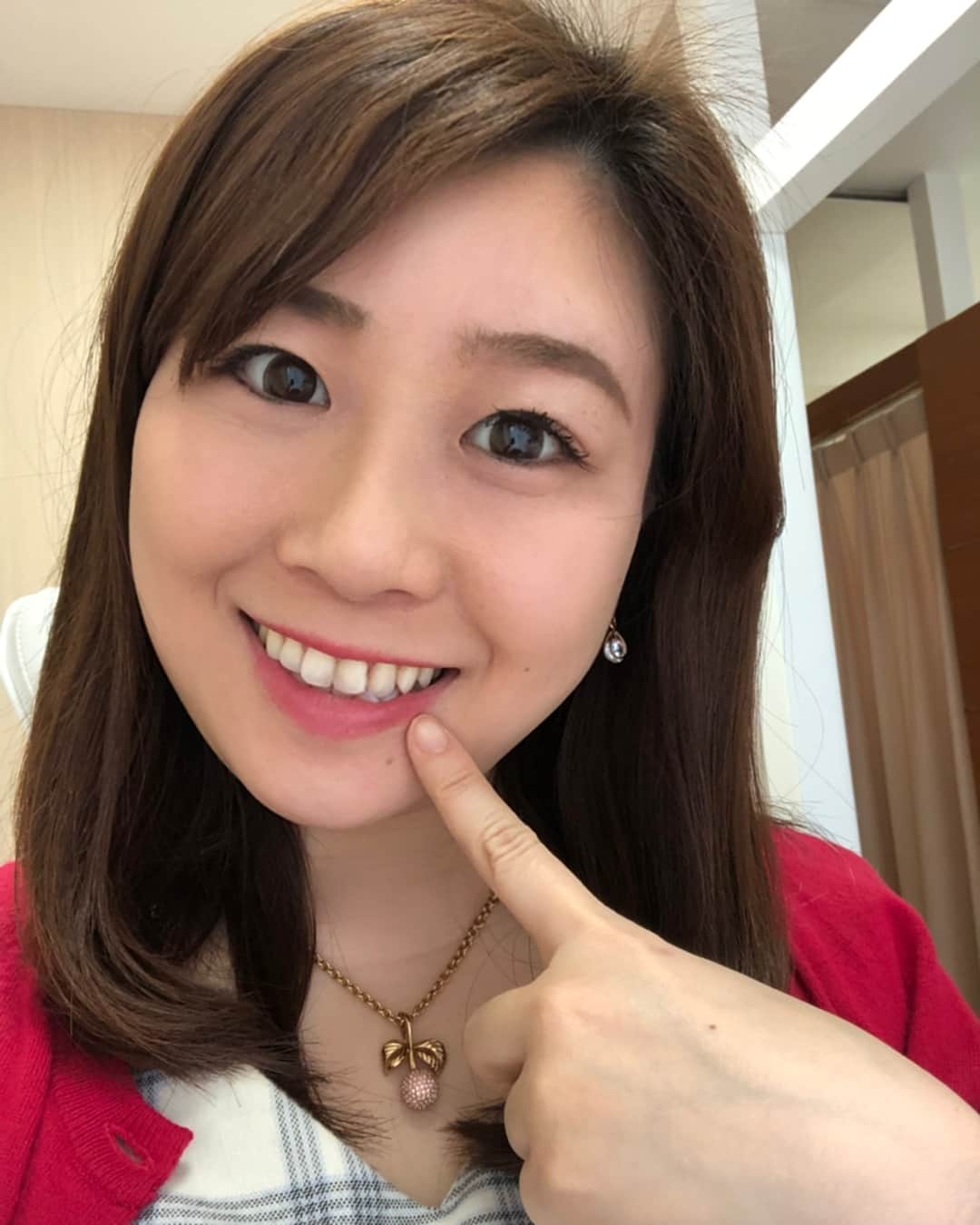 のインスタグラム：「. .【ホワイトニング🦷💕】 .VIOマルシェに行った後、銀座でホワイトニングをしに行きました✨ . .銀座駅近にある東京ビアンコデンタルクリニック🦷 . .10分で効く最新の最高濃度薬剤ということで、、全然痛くなかったです(^^)v . .個人差はあるそうですが、私は2年前にホワイトニングしてから久しぶり。。。 . .歯は3トーン明るくなり歯全体的が透明感のある白さになりました♡ . .ちなみに「金谷有希子アナのインスタ見ました」と予約時に伝えてもらうと、、 . .なんと！銀座院限定(×新宿店)で1回20,000円の施術を2回で10,000円にしてくれるそうです(´⊙ω⊙`)❣️✨ . 矯正などもやっているそうです、ご興味ある方はどうぞ💁‍♀️ . .女医さん(院長)の歯科クリニックです♪ . .★東京ビアンコデンタルクリニック銀座★ 東京都中央区銀座2-8-17 ハビウル銀座Ⅱ 7階 (Daniel Wellingtonのビル) 📞03-6263-0438 . . #矯正#ホワイトニング#銀座ホワイトニング#歯科矯正#whitening#look#白い歯#美容 #フリーアナウンサー金谷有希子 #フリーアナウンサー #ママアナウンサー #女の子ママ #11ヶ月 #断乳完」