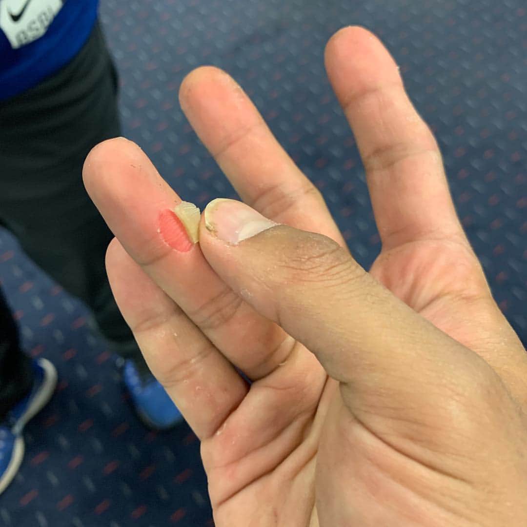 のインスタグラム：「I will be 100% for next start😊 スライダー一球でこうなった。どんな投げ方してんねん笑」