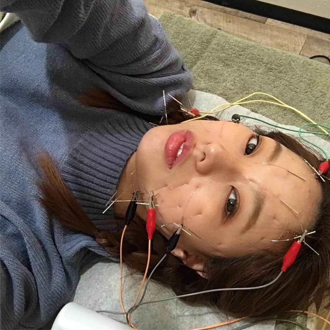 松本さゆきのインスタグラム：「お久しぶりでございます。 なんだかここ最近 姉が風邪をひき 弟へ移り、、っていうお決まりのパターンを2ターンぐらい繰り返し そろそろ私も疲れてきたので 予約してた #美容鍼 行ってきました。 どんだけ心待ちにしてたか🤣 程よい刺激で目の前がスッキリ。 というか、私、4月14日に向けて色々準備しなきゃだわ。。💦 #こもの鍼灸院」