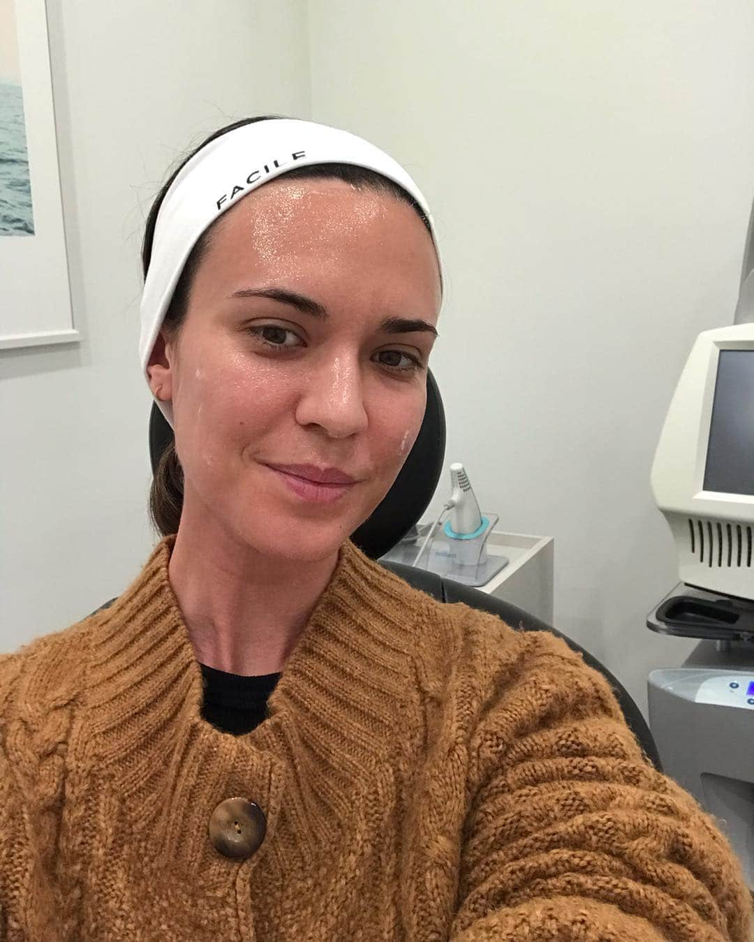 オデット・アナブルさんのインスタグラム写真 - (オデット・アナブルInstagram)「I’ve always struggled with acne scars and I just got some PRP with microneedling done at my new fav. skin place @facileskin and I heard it’s supposed to work wonders. Here’s before, during, and after without any filters so you can see all the real stuff. Check my stories to see more of the whole process. I’m gonna be glowing (I hope 🤞🏽!!!) Thanks @drsamolitis ❤️」3月22日 9時29分 - odetteannable