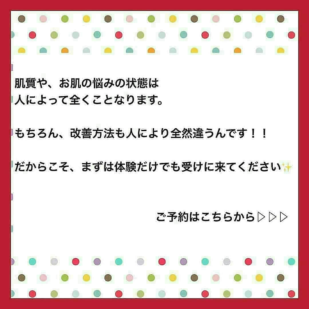 肌質改善専門サロン~Accueil~さんのインスタグラム写真 - (肌質改善専門サロン~Accueil~Instagram)「💙💚💛24日空きあり💛💜❤ * * 【ご予約はこちら👇🏼】 🌟🌟 @accueil_ikebukuro 🌟🌟 . ※今だけ期間限定クーポンあり . . . 肌荒れの原因は人それぞれなのにも関わらず、 周りの人と同じケアをしていませんか💦？？ * ❌お薬を塗っても飲んでも変わらない、、 ❌食事を気にしても肌が荒れる、、 ❌スキンケアを変えてもイマイチ、、 ❌何かしら常にトラブルが肌にある、、 ❌ニキビが繰り返しできる、、 * * そのお悩み解決できちゃいます😌✨ Accueilは、どのサロンに行っても良くならなかったお客さまたちや、 どの皮膚科に行っても変化がなかったお客さまたちが多く訪れてくださっています🙌💕* * * * もう悩まない！！！ 繰り返さないところまでしっかりと根本改善していきます☺️ そろそろ肌荒れから卒業しませんか？ * →→→初回体験はこちらから👉🏼 @accueil_ikebukuro * * * * Accueilでのお手当は、、 * 機械は一切使いません🙅‍♀️❌ 使うお化粧品は １００％天然の「ミネルヴァ化粧品」🌲🍃 ニキビの炎症がある方・アトピーの方でも 安心して受けていただける事ができる お肌にとても優しいエステです♡♡ * * お肌のお悩みなら、何でもお任せください😊💕 * * ■「インスタ見ました！」 で、 初回体験￥26,000 →→✨￥５，９８０✨ * * * --------当サロンのご予約方法≫--------- *  1️⃣当サロンのインスタTopのURL ⭐『Hotpepper Beauty』の 「instagram限定クーポン」にてご予約可能♡♡ * * 2️⃣インスタのDMからご予約 （下記項目を記載の上、お問い合わせください♪） * 🔶お名前（フルネーム） * 🔶お電話番号 * 🔶希望日時（第１～第３希望） * 🔶ご希望のメニュー * * 3️⃣お電話でのご予約✨ 　03-6912-5705にお願いします♡ ----------------------------------------- * * @accueil_ikebukuro ✨ #ニキビ #ニキビ跡 #毛穴 #乾燥肌 #ニキビ跡ケア #肌荒れ #ニキビ跡改善 #ニキビ肌改善 #ニキビ治療 #保湿 #毛穴の黒ずみ #毛穴の開き #スキンケア #毛穴吸引 #アトピー女子 #ニキビ皮膚科  #美肌ケア  #ニキビ専門 #肌質改善 #背中ニキビ #アトピー肌 #乾燥 #ニキビケア #毛穴ケア #アトピー治療 #肌悩み #スキンケア難民 #肌トラブル改善 #スキンケア大事 #目指せ美肌」3月24日 11時08分 - accueil_ikebukuro