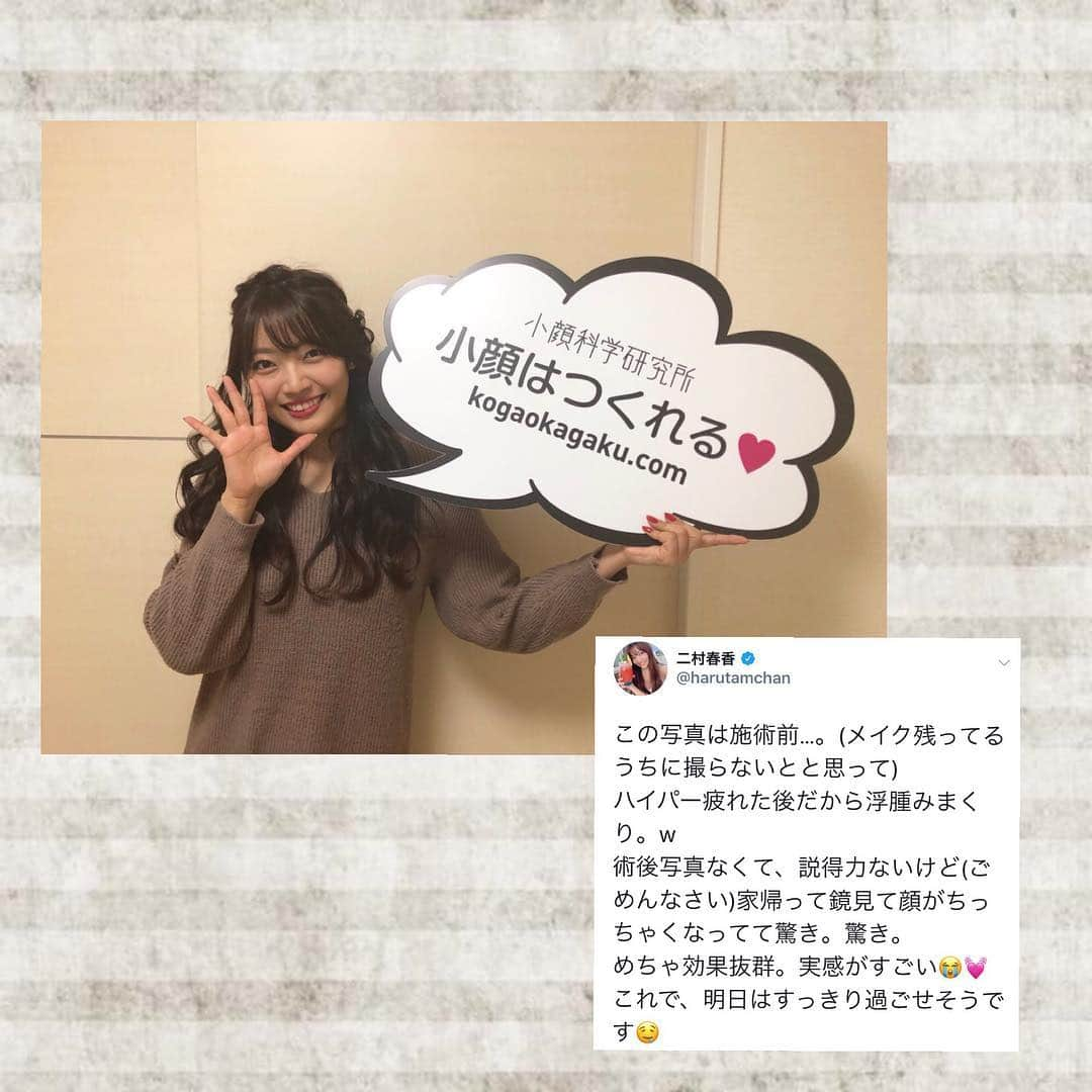 小顔科学研究所 さんのインスタグラム写真 - (小顔科学研究所 Instagram)「元SKE48でタレントの二村春香様が﻿ お越しくださいました♫﻿ ﻿ 「気持ち良さを実感したいから」と﻿ 施術中寝ないようにずっと目見開いて﻿ 睡魔と闘ってました🤣﻿ ﻿ 顔の右半分が大きいのが悩みとのことでしたが﻿ バランス整ってる！﻿ と効果も実感して喜んでいただきました(￣▽￣)﻿ ﻿ ﻿ またのご来店お待ちしております😄 ﻿﻿ ﻿﻿ ﻿﻿ ﻿ 小顔科学研究所は感謝の気持ちを込めて、、、﻿﻿﻿﻿﻿﻿﻿﻿﻿﻿﻿﻿﻿﻿﻿﻿ 各店舗キャンペーン実施中🎶﻿﻿﻿﻿﻿﻿﻿﻿﻿﻿﻿﻿﻿﻿﻿﻿﻿ ﻿﻿﻿﻿﻿﻿﻿﻿﻿﻿ ﻿【圧倒的小顔フルコース 】﻿﻿﻿﻿﻿﻿﻿﻿﻿﻿﻿﻿﻿﻿﻿﻿﻿﻿ 20%オフ 150,400円（税別）﻿﻿﻿﻿﻿﻿﻿﻿﻿﻿﻿﻿﻿﻿﻿﻿﻿﻿ ﻿﻿﻿﻿﻿﻿﻿﻿﻿﻿﻿﻿﻿﻿﻿﻿ ・*:..｡o○☼*ﾟ・*:..｡o○☼*ﾟ・*:..｡o○☼*ﾟ﻿﻿﻿﻿﻿﻿﻿﻿﻿﻿﻿﻿﻿﻿﻿﻿ ﻿﻿﻿﻿﻿﻿﻿﻿﻿﻿﻿﻿﻿﻿﻿﻿ 🌟福岡天神院限定﻿﻿﻿﻿﻿﻿﻿﻿﻿﻿﻿﻿﻿﻿﻿﻿ 【小顔お試しコース】﻿﻿﻿﻿﻿﻿﻿﻿﻿﻿﻿﻿﻿﻿﻿﻿﻿﻿ 50%オフ 19,900(税別)﻿﻿﻿﻿﻿﻿﻿﻿﻿﻿﻿﻿﻿﻿﻿﻿﻿﻿ 【美容鍼コース】﻿﻿﻿﻿﻿﻿﻿﻿﻿﻿﻿﻿﻿﻿﻿﻿﻿﻿ 67%オフ 5,000円(税別)﻿﻿﻿﻿﻿﻿﻿﻿﻿﻿﻿﻿﻿﻿﻿﻿﻿﻿ ﻿﻿﻿﻿﻿﻿﻿﻿﻿﻿﻿﻿﻿﻿﻿﻿﻿﻿ ﻿﻿﻿﻿﻿﻿﻿﻿﻿﻿﻿﻿﻿﻿﻿﻿ ※先着25名様限定！﻿﻿﻿﻿﻿﻿﻿﻿﻿﻿﻿﻿﻿﻿﻿﻿ ﻿﻿﻿﻿﻿﻿﻿﻿﻿﻿﻿﻿﻿﻿﻿﻿﻿﻿ 【受付期間】全コース2019年3月31日迄﻿﻿﻿﻿﻿﻿﻿﻿﻿﻿﻿﻿﻿﻿﻿﻿﻿﻿ ﻿ ﻿﻿﻿﻿﻿﻿﻿﻿﻿﻿﻿﻿﻿﻿﻿﻿﻿﻿ 詳細はホームページのキャンペーンページにて﻿﻿﻿﻿﻿﻿﻿﻿﻿﻿﻿﻿﻿﻿﻿﻿﻿ ﻿﻿ ご案内しておりますので、是非ご覧ください💫﻿﻿﻿﻿﻿﻿﻿﻿﻿﻿﻿﻿﻿﻿﻿﻿﻿﻿﻿ ﻿﻿﻿﻿﻿﻿﻿﻿﻿﻿﻿﻿﻿﻿ Instagram DMからもお問い合わせ可能です★﻿﻿﻿﻿﻿﻿﻿﻿﻿﻿﻿﻿﻿﻿﻿﻿﻿ ﻿﻿﻿﻿﻿﻿﻿﻿﻿﻿﻿﻿﻿﻿﻿﻿﻿ ﻿﻿﻿ #小顔科学研究所 #小顔 #小顔矯正 #小顔はつくれる #痛くない #美容整形後もOK #芸能人 #モデル #俳優 #女優 #骨格矯正 #表参道 #名古屋栄 #心斎橋 #福岡天神 #個人差あり #骨盤矯正 #美姿勢矯正 #美脚矯正 #美容鍼 #デトックス #kogao #smallerface  #二村春香  #ske48 #treatment #beauty」3月24日 14時36分 - kogaokagaku