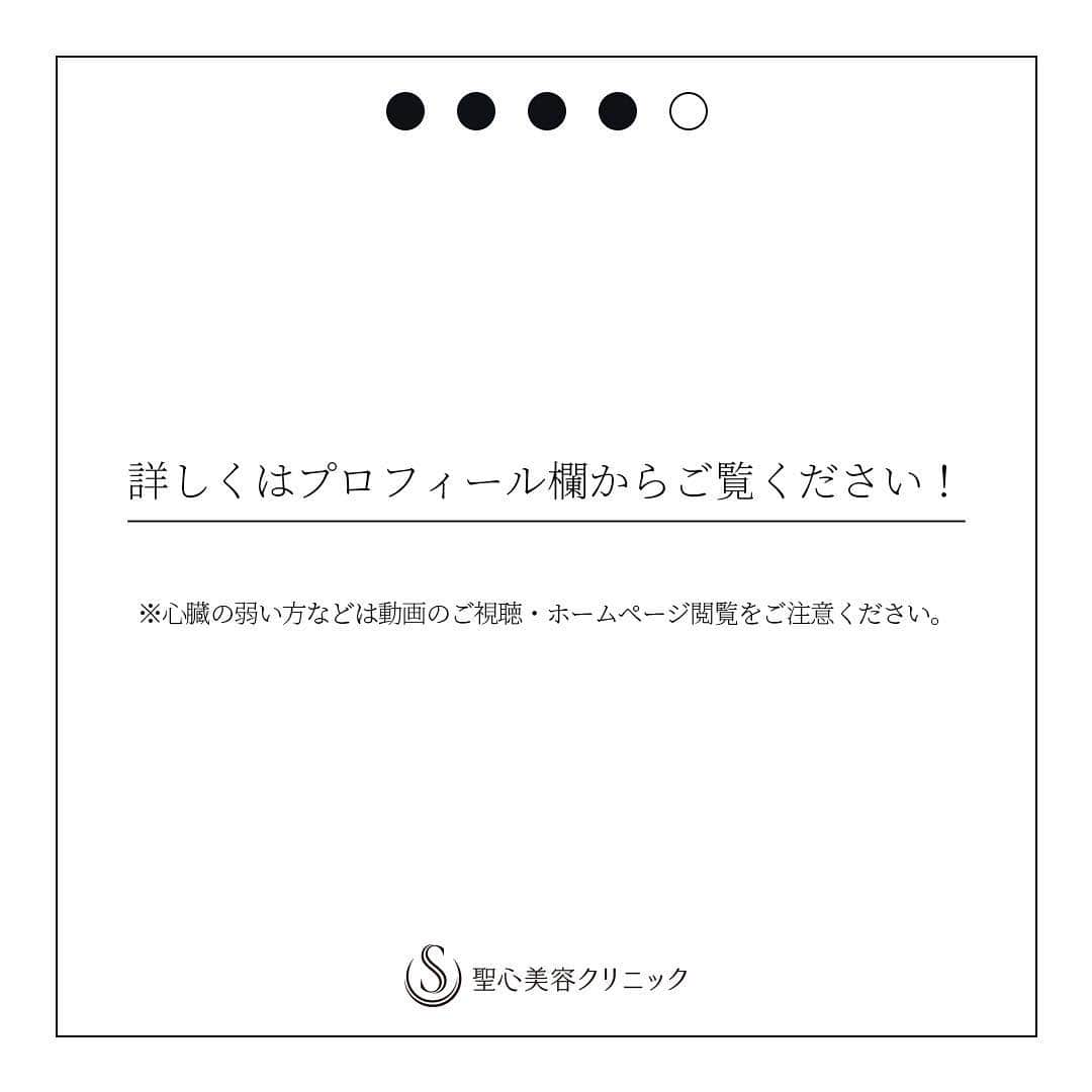 聖心美容クリニック公式アカウント さんのインスタグラム写真 - (聖心美容クリニック公式アカウント Instagram)「.﻿ 聖心美容クリニックが目指すのは「人を幸せにする美容医療」です。﻿ ﻿ そのために「とことん真面目に、美容医療」を志す私たちは、﻿ 一人でも多くの患者さまの「美」への願いを叶えるため、﻿ 「とことん真面目」な願いを込めた啓蒙動画を本日公開いたしました。﻿ ﻿ 一人でも多くの方にこの「現実」と「願い」を知っていただければ幸いです。﻿ ーー➖ーー➖ーー➖ーー➖ーー➖﻿ 「#RealUgly 本当の醜さにメスを。」﻿ ﻿ 昨今、「人を幸せにする美容医療本来の役割」の需要は高まっています。﻿ ﻿ つい最近も有名芸能人の方が整形でご自身のコンプレックスを解消し、笑顔を取り戻されたという素敵なニュースもありました。﻿ ﻿ 今後も美容医療はますます身近なものになっていくと考えます。だからこそ、これまでも注意喚起や規制があったにも関わらず、被害が後を絶たない“悪徳美容クリニックの問題を、今こそ世の中ゴト化すべき”だと私たちは思いました。﻿ ﻿ そのため、悪徳美容クリニックの手口を、身体の特徴として擬人化した醜い医師「Dr .Beast（ドクタービースト）」を制作し、注意喚起のための映像と正しい美容医療クリニック選びの啓蒙活動を実施いたします。﻿ ﻿ 映像ではあえてショッキングな「現実」をそのまま見ていただくことで、「なんとなく」は知られていたかもしれない、問題の重要性や対策の必要性を改めて知って頂きたいです。﻿ ﻿ そして今も、これからも、正しい美容医療を受けていただきたい全ての患者さまの、悪徳美容クリニックの被害に遭わないための見極める目を養う手助けに、「美」の願いを叶える手助けになれば、これ以上の喜びはありません。﻿ ﻿ ※映像には、ショッキングな「現実」が描かれています。閲覧には十分ご注意ください。﻿ ※動画とその詳細については、プロフィール欄のURLからご確認いただけます。 ﻿ _﻿ #RealUgly #DrBeast #本当の醜さにメスを #私たちは絶対に醜くなるな #とことん真面目に美容医療 #美容医療 #想い #啓蒙活動﻿ _﻿ #美容クリニック #聖心美容クリニック #seishinbiyou」3月25日 19時02分 - seishinbiyou