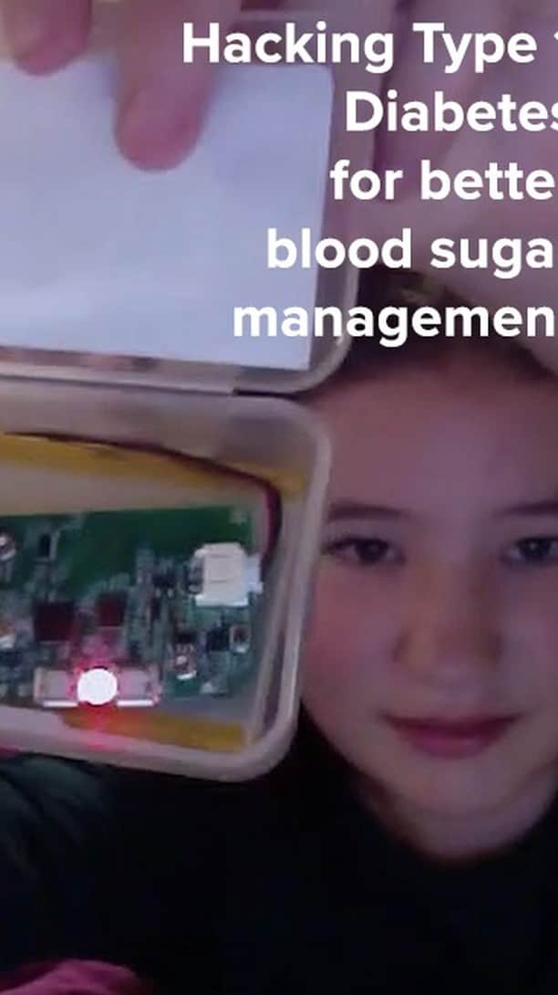 のインスタグラム：「Type 1 diabetes is a disease that affects more than 1.2 million Americans. A few years ago, people figured out how to hack their insulin pumps to make them more precise. CNBC’s Erin Black, who was diagnosed with Type 1 diabetes 20 years ago, decided to try out the hacked system. Here’s what happened.  #Diabetes #Type1Diabetes #Health #HealthTech #Hacking #Insulin #Diabetesawareness #Diabetic #Livebeyond #BeyondType1 #Type1Warrior #DisruptDiabetes #Healthy #Change #T1dstrong #Technology #tech #News #CNBC」