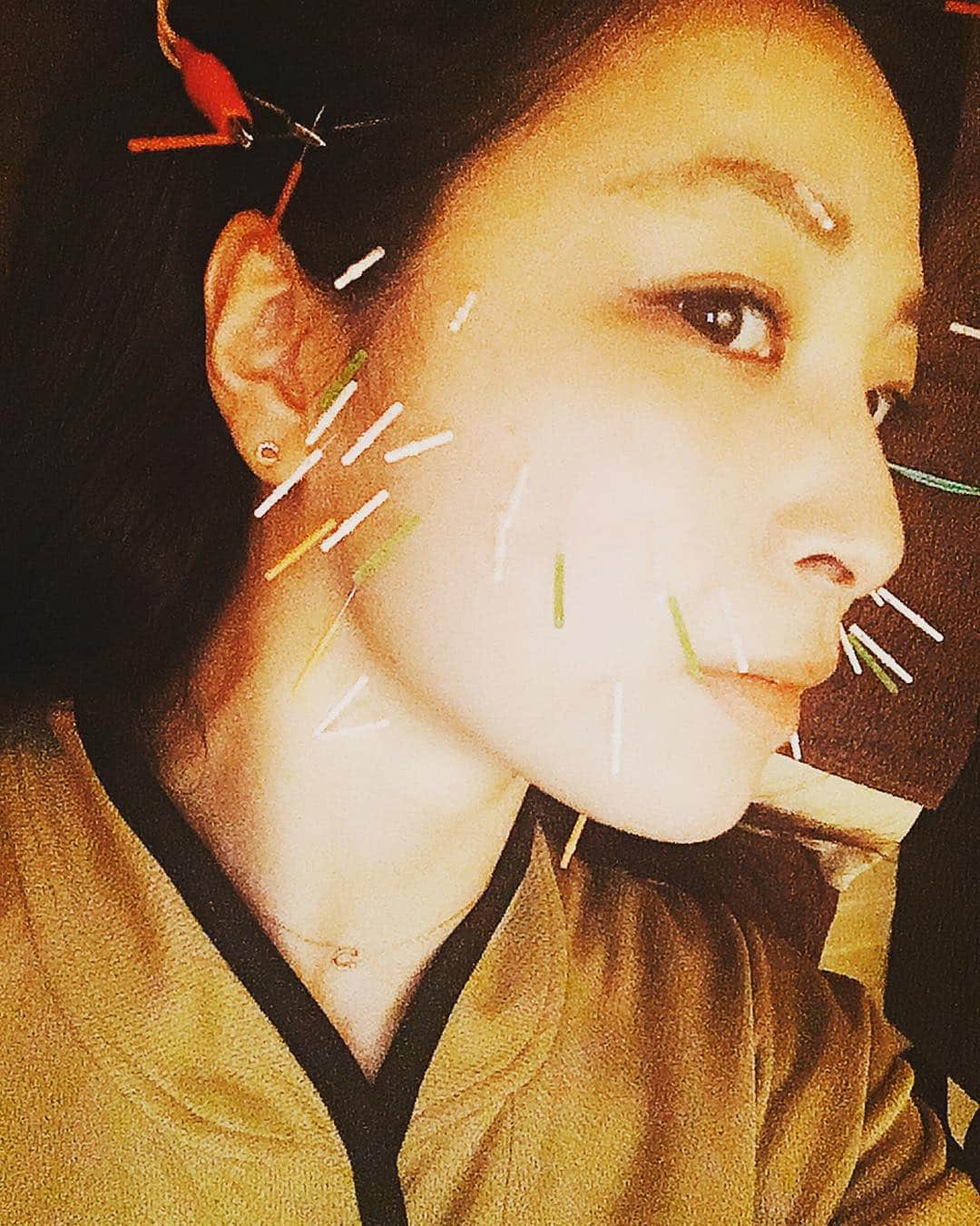 のインスタグラム：「. . . バリラグゼ  に、行ってきました🚗 ³₃ . . 全身ほぐしと美容鍼を してもらってきました👗✨ . 顔も体もスッキリ😉🌈 . 佐藤あり紗の紹介と 予約時や、入店の際に伝えてもらうと 💰500円お安くなります☺️💜 . 男性の施術する方もいますし 男性の方でもwelcomeです🦁🌈 . 仕切られているので落ち着いて 施術を受けられます! 私は.毎度眠ってしまいそうになります⋆｡˚⋆｡˚✩( ¯꒳¯ )ᐝ笑 . メニューも多彩で毎回どのメニューにするか お店に入るまで迷っています😂 . お店の入口には 私のサインTシャツとサイン色紙も飾ってもらっています🥰 . 私のトークショーや講演会で 美容についてもお話させてもらっています!! . . 💄お問い合わせ💄  予約可能です🦄  住所🏡: 宮城県仙台市青葉区国分町2丁目3-12 柴山ビル5階  電話番号☎️: 022-395-6727 . . #バリラグゼ #balilaxe #ばりらぐぜ #宮城県 #仙台市 #国分町  #美容鍼 #針 #マッサージ #アロママッサージ #アロマ #エステ #リラクゼーション #癒し #癒し空間  #美容 #健康 #バレーボール #アスリート #スポーツ  #バレー教室 #出張バレー教室 #講演会 #トークショー #スポンサー #サポート #感謝 #佐藤あり紗割引 #佐藤あり紗スポンサー #佐藤あり紗」