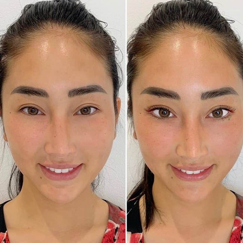 筒井菜月のインスタグラム：「ガングロですが... 去年の夏に毎朝5時起きでサーフィン🏄‍♀️を週5でしていた時の写真🤗  サーフィンの激しい波で日焼け止めは一瞬で落ちます(⌒-⌒; )  #美白 も大事ですが、太陽の光を浴びると幸せホルモン #セロトニン の元になる #メラトニン が分泌されて健康にも良いんですよ💕  さて 日焼けは置いといて  別人と思うくらい左右で顔が違いますね💦  左は #アイラインエクステ #カラーアイラインエクステ を つける前の状態ですΣ（・□・；） 右は #アイラインエクステ #カラーアイラインエクステ をつけた後の状態❤️ 目が1.5倍になってます👀✨ ※ #マツエク の効果が分かりやすいようにすっぴんで撮影しています😊  この後も #サーフィン に行ったり 目をこすったりしていましたが、美しい状態が長持ちしました🥰  #アイラインエクステ #カラーアイラインエクステ の良いところは、#メイク いらずなところです✨  なるべくメイクは #時短 したいタイプなので、とっても助かりました💕  #ズボラ女子 な私の救世主でした✨  ここぞという時の勝負にもピッタリなので、もっと綺麗になりたい女子の皆さん、 @angela_maki さんにお店で相談してみてくださいね❤️ #Angela #幡ヶ谷 #カラーアイラインエクステ #アイラインエクステ #マツエク #美 #メイク #ミスコン #ミスインターナショナル #技術 #missinternational #missjapan #ミスジャパン #開運道アドバイザー #占い #開運 #パワースポット #筒井菜月」