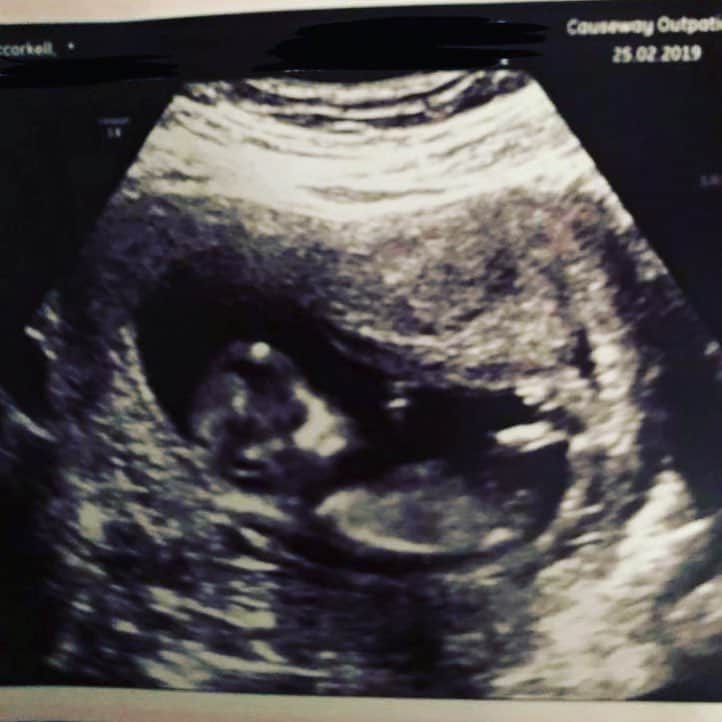 ジェナ・マッコーケルさんのインスタグラム写真 - (ジェナ・マッコーケルInstagram)「When 2 becomes 3.... we are so excited to welcome little baby Van der Perren to the world! 💖💙🍼👶🏻 @kevinvanderperren」3月27日 5時53分 - jenna_mccorkell