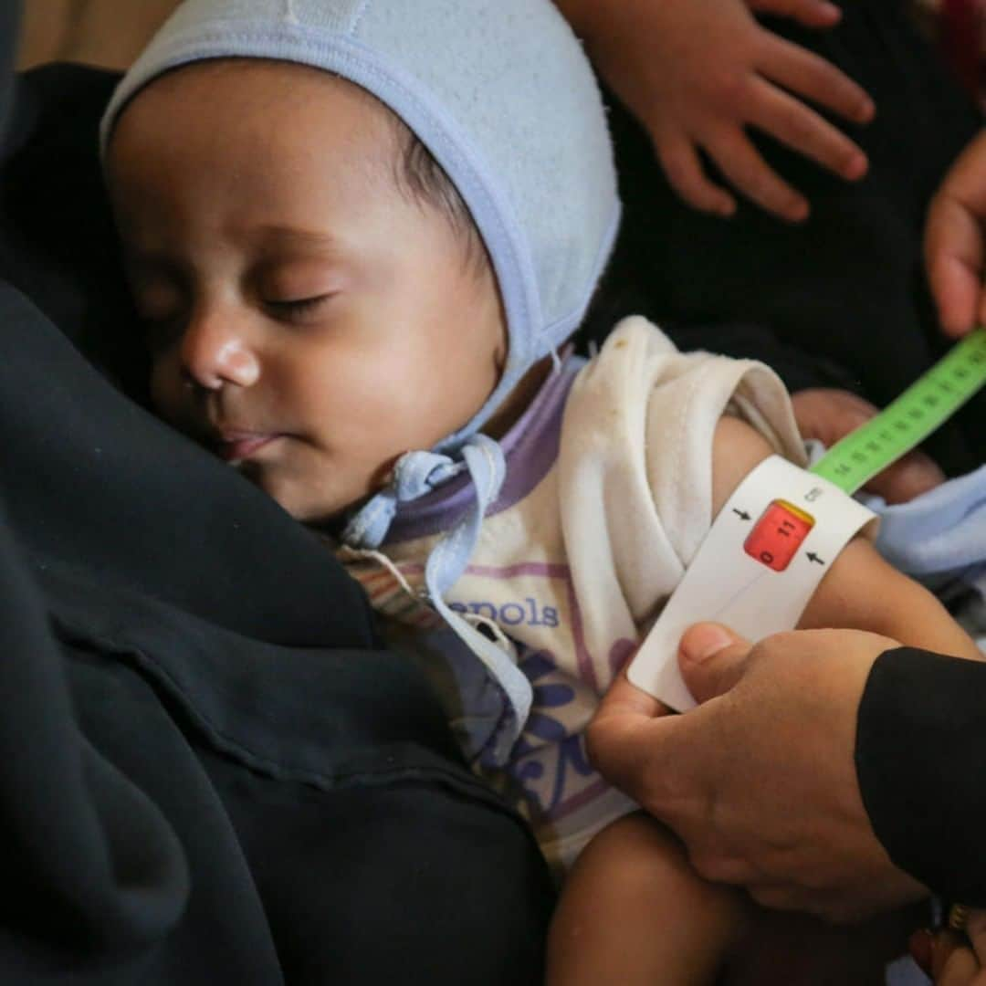 unicefさんのインスタグラム写真 - (unicefInstagram)「Salem, 7-months-old, is being screened for malnutrition in #Yemen. As the crisis continues, we're on the ground helping to provide life-saving support to children and their families.  #ChildrenUnderAttack © UNICEF/UN0291546/Fuad」3月28日 0時45分 - unicef