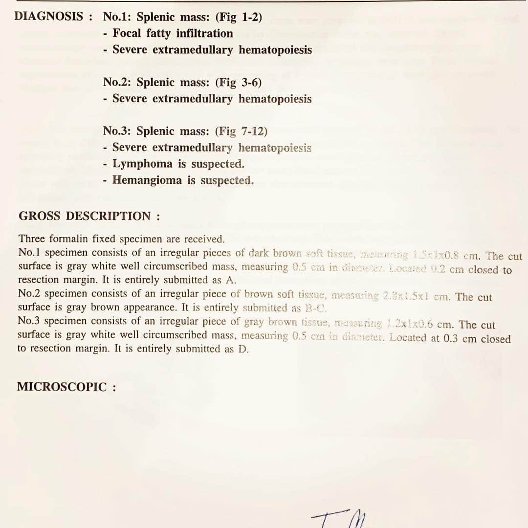 Ella Chuffyさんのインスタグラム写真 - (Ella ChuffyInstagram)「Fact: Chuffy got cancer. It’s a lymphoma one.  And the most important thing is he will not die.  We consulted with his vet and confirmed that if we are truly take a really...really good care of him, he will live 1-5 more years.  He’s now 16. Another 4 or 5 years is a wonderful bless. 🧡❤️ . . . . . . . . #ellachuffy #pet #petstagram #pomeranianpage #pomeraniansofinstagram #teacuppoms #cutedogs #pomeranian_lovers #pomeranianlife #pomeranianworld #teddybeardog #pomeranian #puppylove #aplacetolovedogs #dogoftheday #justpomeranians #fluffypack #dogoftheday #anmlsposts #thedailypompom #picoftheday #iflmdog #犬 #狗 #everydaydoglover #puppy #собаки #seniordog」3月30日 21時11分 - missdiad