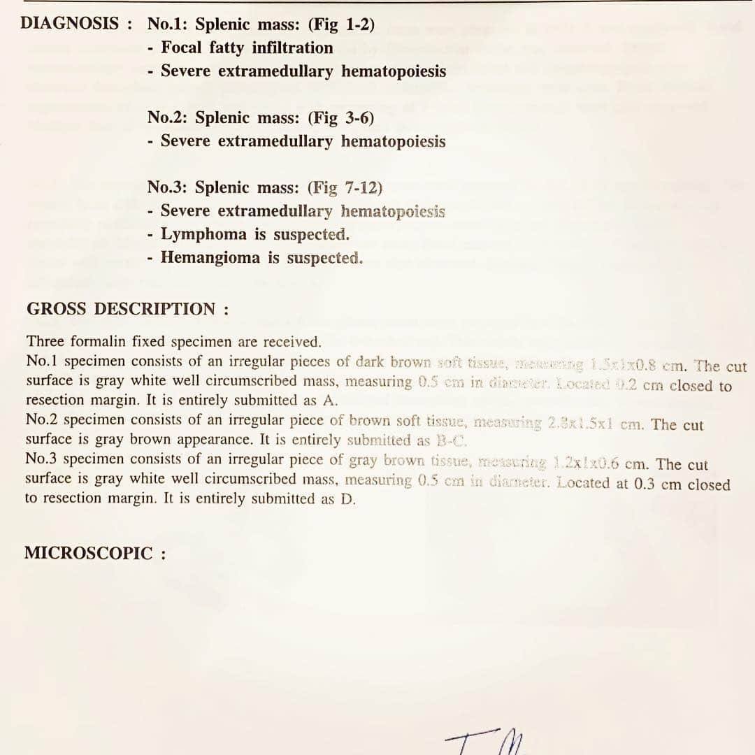 Ella Chuffyさんのインスタグラム写真 - (Ella ChuffyInstagram)「Fact: Chuffy got cancer. It’s a lymphoma one.  And the most important thing is he will not die.  We consulted with his vet and confirmed that if we are truly take a really...really good care of him, he will live 1-5 more years.  He’s now 16. Another 4 or 5 years is a wonderful bless. 🧡❤️ . . . . . . . . #ellachuffy #pet #petstagram #pomeranianpage #pomeraniansofinstagram #teacuppoms #cutedogs #pomeranian_lovers #pomeranianlife #pomeranianworld #teddybeardog #pomeranian #puppylove #aplacetolovedogs #dogoftheday #justpomeranians #fluffypack #dogoftheday #anmlsposts #thedailypompom #picoftheday #iflmdog #犬 #狗 #everydaydoglover #puppy #собаки #seniordog」3月30日 21時11分 - missdiad