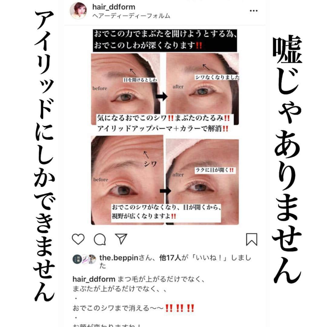 KIRAさんのインスタグラム写真 - (KIRAInstagram)「あの日受講した時は まつ毛が上がるだけで 本当にって すべてが信じられないと思っていたはず、、、 今こうして 画像見てホッとします  お客様の為なんて かっこいいこと 言ってるなって思うかもしれないが  このアイリッドアップパーマは そういうこと  施術する側もそれぞれ 覚悟して受講されだと思います  この生徒さんも 酷いアレルギーで 鼻 目 ぐちゃぐちゃに そして 妊婦さん  アイリッドアップパーマは 画像見るだけで伝わるものがあると 思います  本題に  目の開きが悪いことを眼瞼下垂症といいます。眼瞼下垂症があると頑張って目を開こうとするため、同時に額にもシワがよります。  目を開ける眼筋を上げることによって ご本人が一番目を開けるだけのことなんですが楽になります  その為 頭痛 肩凝りが軽滅します  ご質問・ご相談 気軽にお問い合わせ下さい😊 ・ #まつ毛パーマ #まぶた上げパーマ #ラッシュパーミングアイリスター#ラッシュパーミング#輝式まぶた上げ #眼瞼下垂症#アイリスト#下まつ毛パーマ #沖縄美容師 #沖縄美容室 #まつ毛パーマセミナー #アイリスト #まぶたが柔らかい #アイリッドアップパーマ #まつ毛カラー #ラッシュリフト  #アイリッドダウンパーマ #福岡美容室 #マツエク#まつ毛エクステ  #シリコンロット#韓国eyelash #一重まぶた #二重まぶた #まつげ #下まつ毛パーマ#次世代まつ毛パーマ#沖縄まつ毛パーマ #LashPermingeyeListar#経営者#整形」3月31日 7時03分 - thekirastory