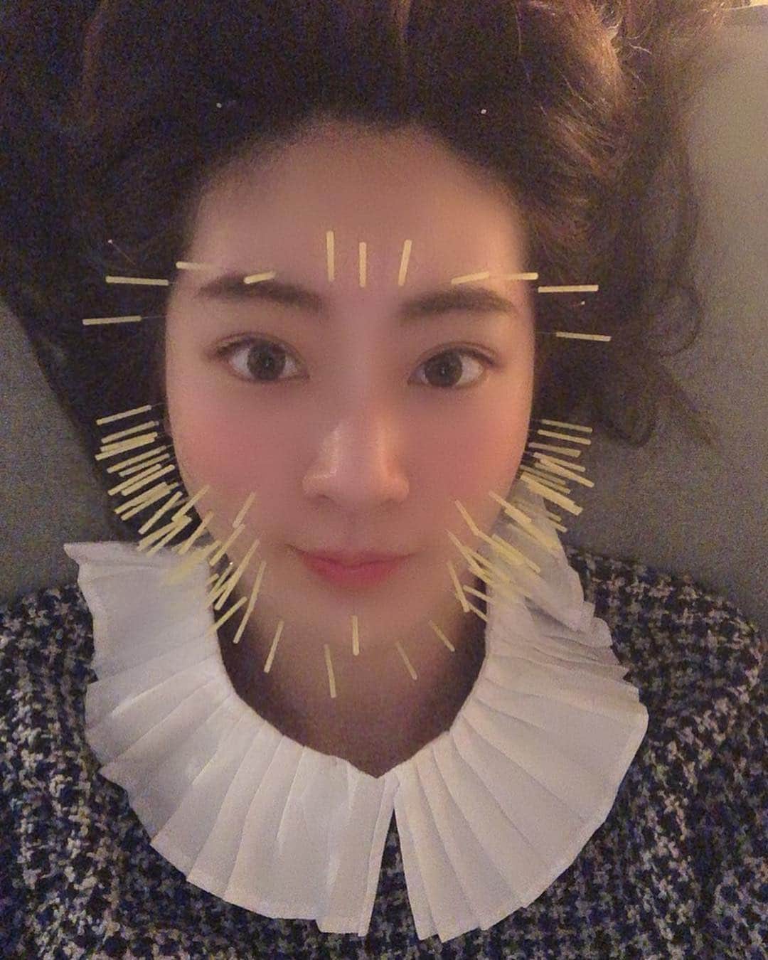 伊藤愛梨さんのインスタグラム写真 - (伊藤愛梨Instagram)「人生初❣️❣️代官山メディカル整体院で (@daikanyama_medical )美容鍼してきました〜🤗実は前々から興味があったの🤭鍼80本刺して頂きました！ 肌の自然治癒力が上がるみたいです❣️ 時間が経ってからさらに美肌効果が出るらしいので経過が楽しみです💭💕 . . . . . . . . . . #スキンケア #肌荒れ改善  #美容鍼 #美容好き #お洒落になりたい #美容鍼 #ニキビ #小顔になりたい #綺麗になりたい #ニキビケア  #美容 #たるみ #むくみ #小顔矯正 #今日のメイク  #自分磨き #化粧品 #likeforlikes #休日の過ごし方 #女子力アップ #美容皮膚科 #美肌ケア #美容day #いいね返し #アンチエイジング #instagood #likeforlikes #小顔  #代官山メディカル整体院」4月1日 16時46分 - ilovely1007_