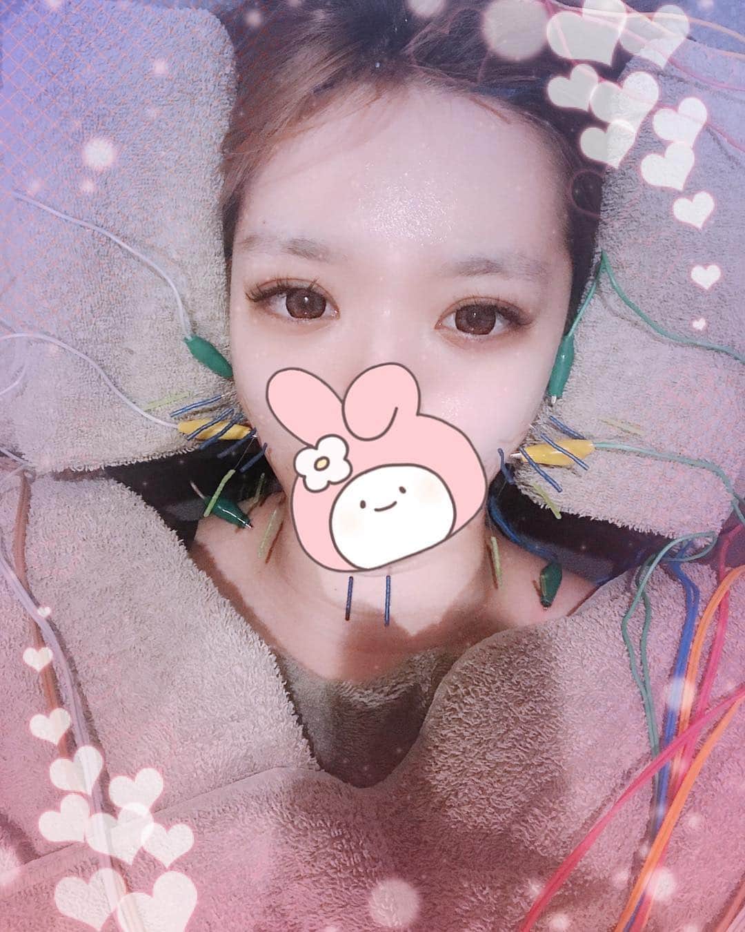 優月心菜さんのインスタグラム写真 - (優月心菜Instagram)「今日も行ってきましたあああ！ 今日は、美極鍼コース🤤🤤🤤❤️ #ハリッチ  #美容鍼灸  #鍼灸  #美顔針」4月2日 17時04分 - yuzuki_cocona