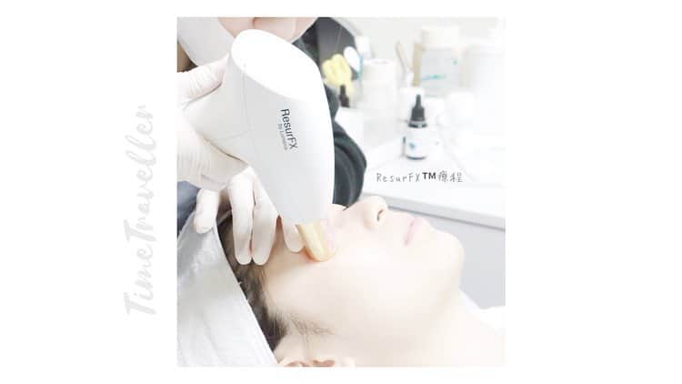 HauTung 巧童在這さんのインスタグラム写真 - (HauTung 巧童在這Instagram)「/ 用家超級詳文 ((向後拉有小小小影片喔 一直都深受雀斑同黑眼圈問題所困擾 以為平常睡眠不足和睡眠品質所影響💤 但與顧問資訊後 才發現原來我皮膚底層有許多微絲血管爆裂及黑色素 所以要從根本入手才能解決問題  於是 顧問建議使用OPT ™️/ Resur FX ™️深層解決肌膚問題  1/ 雀斑及色素問題全面使用了Lumenis M22 的 OPT™️ 使用時第一ROUND會暖暖的 第二ROUND則像被橡筋彈哈哈 當然越接近色素的位置 感覺會加深 整個過程我是能接受的✌🏻肌膚因吸收特定波長的光能後轉化成熱能被破壞✨輕鬆改善日曬色斑、微絲血管顯現等護理  2/ 黑眼圈問題使用了Resur FX ™️ 以打印方式進行治療 採用Erbium 1565nm 光纖激光和最先進獨有專利的 Coolscan 掃描技術 可以深層刺激肌膚膠原增生和改善膚質✨✨尤其是減淡眼部的色素沈澱阿 (!) 一星期內色素就會開始凋落  基本上是暫時看不到有什麼特別的不同的地方 因為它是先處理你底層的問題 容易令你表面的肌膚變好 (( 但總覺得皮膚有變得透亮光滑👀🙈 . @ttuaclub  https://www.ttuac.com.hk/ 立即查詢：27884998 / 68816662 敏感泛紅 | 色斑 | 暗瘡 | 毛孔粗大 | 紋理 | 疤痕 | 痣癦 | 多餘毛髮 | 膚色不均 | 乾燥」4月3日 15時49分 - hautunnng