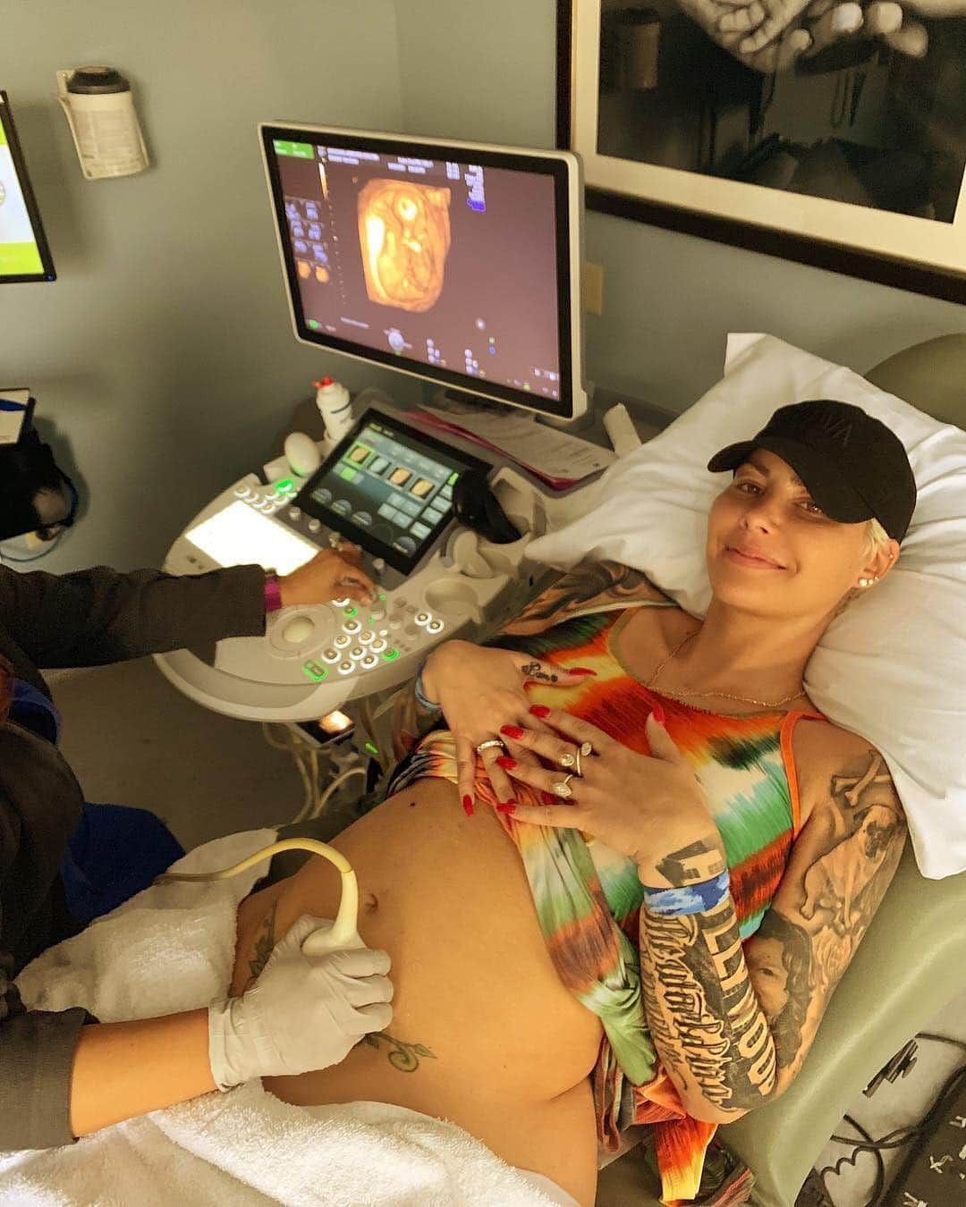 E! Onlineさんのインスタグラム写真 - (E! OnlineInstagram)「Amber Rose is pregnant with a baby boy! Link in bio for everything we know about baby no. 2 and her boyfriend Alexander Edwards. (📷: @amberrose)」4月4日 7時44分 - enews