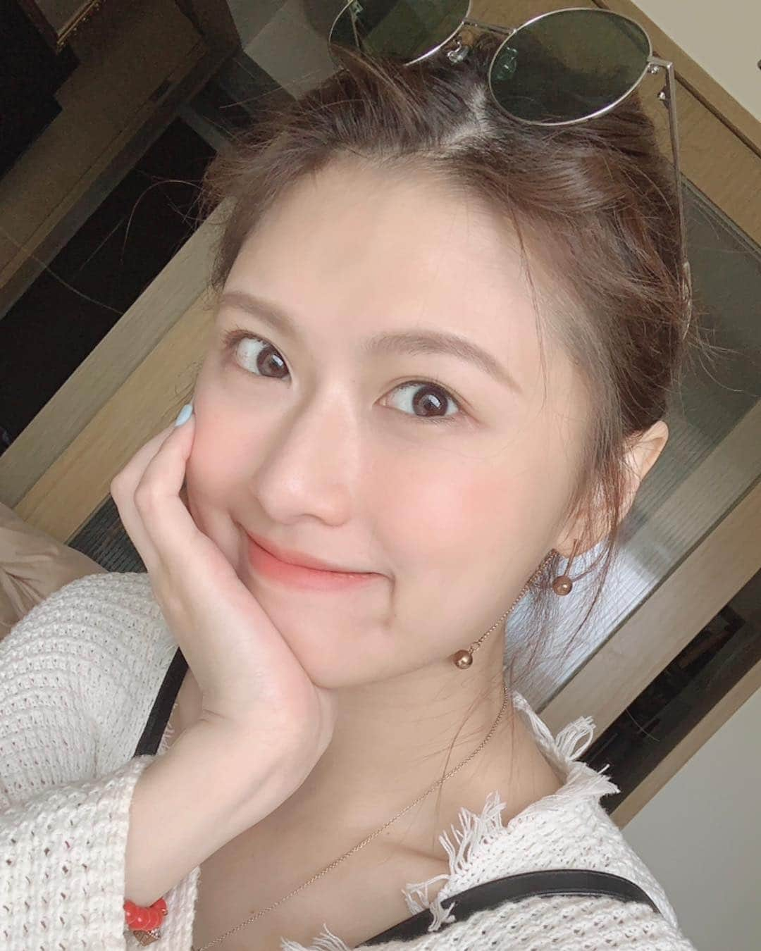 NueNueさんのインスタグラム写真 - (NueNueInstagram)「身體大過敏 幸好臉上沒有淪陷🤪」4月29日 14時03分 - iop_1004