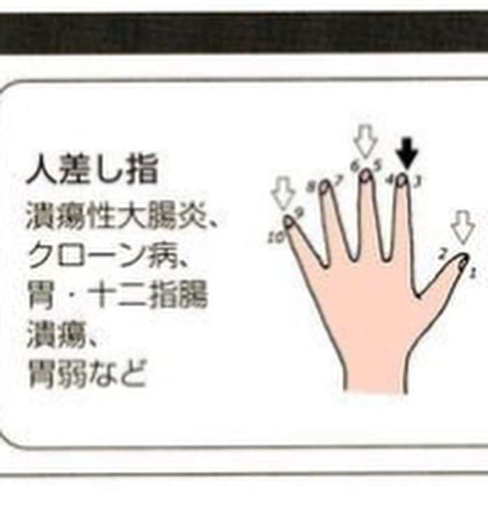 kogao283さんのインスタグラム写真 - (kogao283Instagram)「爪の生え際から、２ミリほどの指の付け根側を刺激します。  もみ方は、一方の手の親指と人差し指で、 もう一方の手の爪の生え際を両側からつまみ、そのまま押しもみします。 普通は、１０秒ずつします。 ・ 念入りにもむ指は、２０秒くらい押して下さい。 一日１～２回くらいのペースでいいでしょう。 ・ 押すときの強さは、爪の生え際にやや強めの痛みを感じるくらいです。弱すぎると効果がないので、痛いなと感じるくらい押します。 ・ 人によっては、症状が一時的に悪くなったり、手が熱っぽく感じられることがあるようです ・ しかし、これは病気が良くなる前の生理的な反応なので、心配せずに刺激は続けます。 ・ ・  たとえば、右手の親指を刺激する場合は 左手の親指と人差し指で みぎての爪の付け根をギュッと挟んで刺激します。 厳密な位置にこだわらなくても、刺激は十分伝わります。 もむ時は、ギュッギュッともんでも、 ギューッと押し続けても結構です。  少し、痛いけど気持ちいい刺激が得られるようにします。  出血したり、アザになるほど強く刺激するのは禁物です。 ・ #睡眠改善 #睡眠障害 #睡眠負債 #美容情報#女子力#美意識 #ダイエット#アンチエイジング#小顔ヘア#ブライダルヘアメイク #ブライダル前撮り #ブライダルネイル #美容整形#ヨガ#ストレッチ#ジム#リンパマッサージ#スキンケア#ヘアアレンジ#スキンケア#ブライダルエステ#マツエク#カットモデル#体質改善#小顔整形#小顔矯正#温活#妊活アカウント#東京小顔#東京サロン」4月29日 22時50分 - kogao283