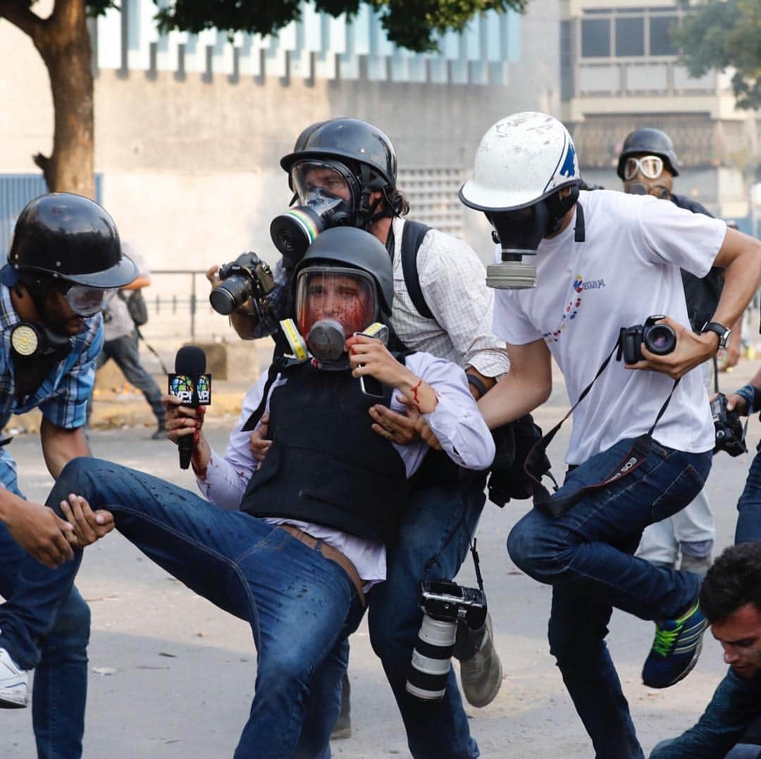 NBC Newsさんのインスタグラム写真 - (NBC NewsInstagram)「Journalists help reporter Gregory Jaimes, who was injured while covering clashes between security forces and anti-government protesters in the Altamira neighborhood of #Caracas, #Venezuela. . Opposition leader Juan Guaidó called for Venezuelans to fill streets around the country Wednesday to demand Nicolás Maduro's ousting. . 📷 Ariana Cubillos / @apnews」5月2日 11時13分 - nbcnews
