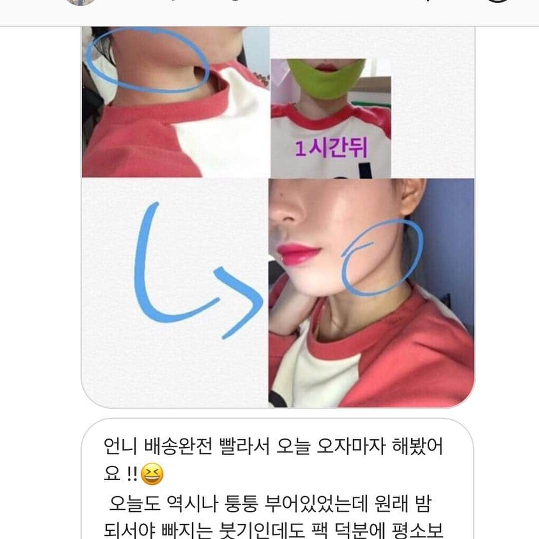 ダユンさんのインスタグラム写真 - (ダユンInstagram)「🚨 리프팅밴드 많은 후기들은 인스타 스토리 모음집 참고해주세요 ♥️ 제가 무료나눔 이벤트 진행했던 리프팅밴드 기억하시나요?! 오랫동안 저의 인스타에 #미니슈링크 와 함께 등장했던 #리프팅밴드 💛 드디어 인터넷 최저가보다 30% 할인된 가격으로 가져왔어요 ! 10일부터 12일까지 저의 인스타 프로필 링크 타고 가시면 할인 된 가격으로 구매 가능합니당 🙏🏻 평소 가격이 조금 사악해서 늘 아끼면서  촬영 날이나 특별한 날에만 썼었거든요 !  전 아무래도 안면윤곽 수술을 해서  남들보다 더 몇배로 피부 리프팅과 V라인  붓기를 신경써야 하거든요 😭 진짜 미친듯이 눈에 불키고 좋다는 여러 제품 다 써봤는데  저에게 눈에 딱 보이는 효과를 본 건 이 제품이였어요 !  아무래도 슈링크 리프팅을 개발한 회사의 제품이고  제가 미니슈링크를 썼을때도 너무 만족하고  신세계를 경험했었는데 역시나 이 리프팅밴드도  너무너무 좋더라구요 . 공구 하기전에  주변 친구들에게도 진짜 많이 나눠주고 써보라고 했었고 이 리프팅밴드 처음 나온 버전부터 최신 버전까지  다 써본 결과 , 지금 최신버전이 정말 대박이요 ! 저처럼 정말 잘 붓는 타입이신 분들 정말 만족하실 거에요 ! 그리고 미니슈링크랑 같이 사용하면 효과 진짜 빵빵하게 볼 수 있어요 🤭 산증인 .. 제가 예전에 올렸던 메이크업 동영상에서 보면  세수하고 밴드 붙이고 머리 말리고 한 40분넘게 붙여주고  떼었을 때 눈에 바로 효과가 보이더라구요 👍🏻 그래서 사람들이 어디꺼냐 , 나라를 가리지 않고  엄청 문의가 많이 왔었어요 ,  그래서 “아 그래도 더 꾸준히 써보고 후기를 알려주자” 해서  꾸준하게 몇개월간 쓴 결과 그냥 저는 대. 만. 족 + 미니슈링크 공구 하기 전부터  친 언니가 집에 가져온 샘플을 써봤을 때 너무 만족해서  미니슈링크 공구 할때쯤 샘플을 많이 받아서  정~말 꾸준히 몇개월 간 사용해보고  제가 가져온거에요  넘 조와서 !! 그리고 이 좋은거 비싸게 구매하는 것 보다  저렴하게 구매하면 더 좋잖아요! 🚨🚨 보통 저는 중요한 날 전날 저녁에 샤워 다하고 스킨케어 후  리프팅 밴드 붙이고 자요! 그리고 아침에 뗍니다 !  아니면 아침에 머리말릴때 붙이고  화장하기 전에 떼고 화장해요 💜 팩을 냉장고에 따로 넣어 놓지 않아도  쿨링감 있어서 정말 붓기도 싹 잡아줘요 !  귀가 좀 뒤에 있거나 얼굴이 긴 편이라면  사용하기전에 세번정도 잡아늘려준 뒤 쓰시면  귀가 덜 아프답니당 ෆ╹ .̮ ╹ෆ 참고로 팩은 일회용입니당 :) 💗 펩타이드(분홍) 더 쫀쫀하게 리프팅만 강력하게 잡고싶다! 💚 시카(연두) 병풀 추출물이 들어있어서  여드름+리프팅 동시에 잡고싶다 !  이렇게 생각하면 될거같아요 🙏🏻 전 둘다 그날그날 피부 컨디션에 다르게 써요 :) ✈️✈️ It will start selling overseas on the 15th.」4月10日 11時11分 - 2__yun__2