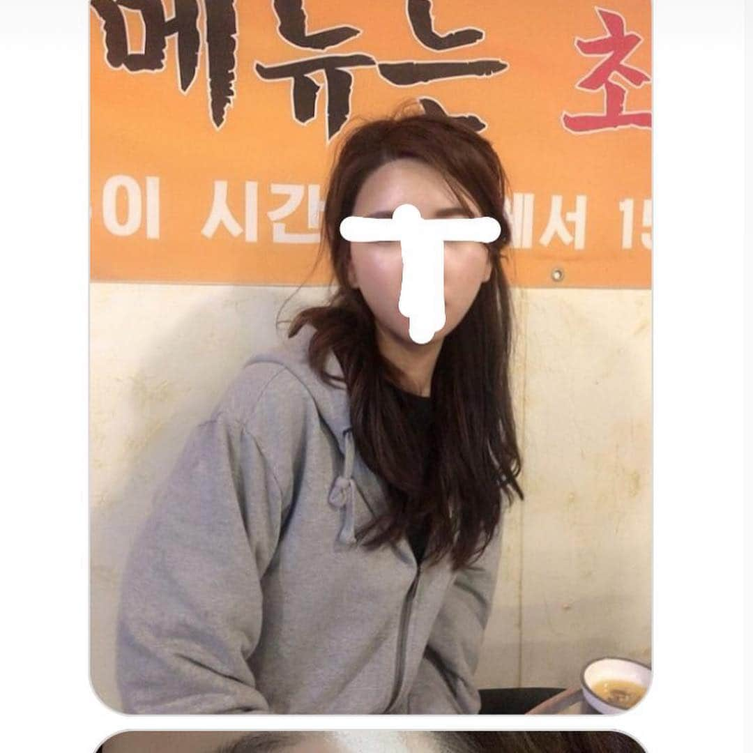 ダユンさんのインスタグラム写真 - (ダユンInstagram)「🚨 리프팅밴드 많은 후기들은 인스타 스토리 모음집 참고해주세요 ♥️ 제가 무료나눔 이벤트 진행했던 리프팅밴드 기억하시나요?! 오랫동안 저의 인스타에 #미니슈링크 와 함께 등장했던 #리프팅밴드 💛 드디어 인터넷 최저가보다 30% 할인된 가격으로 가져왔어요 ! 10일부터 12일까지 저의 인스타 프로필 링크 타고 가시면 할인 된 가격으로 구매 가능합니당 🙏🏻 평소 가격이 조금 사악해서 늘 아끼면서  촬영 날이나 특별한 날에만 썼었거든요 !  전 아무래도 안면윤곽 수술을 해서  남들보다 더 몇배로 피부 리프팅과 V라인  붓기를 신경써야 하거든요 😭 진짜 미친듯이 눈에 불키고 좋다는 여러 제품 다 써봤는데  저에게 눈에 딱 보이는 효과를 본 건 이 제품이였어요 !  아무래도 슈링크 리프팅을 개발한 회사의 제품이고  제가 미니슈링크를 썼을때도 너무 만족하고  신세계를 경험했었는데 역시나 이 리프팅밴드도  너무너무 좋더라구요 . 공구 하기전에  주변 친구들에게도 진짜 많이 나눠주고 써보라고 했었고 이 리프팅밴드 처음 나온 버전부터 최신 버전까지  다 써본 결과 , 지금 최신버전이 정말 대박이요 ! 저처럼 정말 잘 붓는 타입이신 분들 정말 만족하실 거에요 ! 그리고 미니슈링크랑 같이 사용하면 효과 진짜 빵빵하게 볼 수 있어요 🤭 산증인 .. 제가 예전에 올렸던 메이크업 동영상에서 보면  세수하고 밴드 붙이고 머리 말리고 한 40분넘게 붙여주고  떼었을 때 눈에 바로 효과가 보이더라구요 👍🏻 그래서 사람들이 어디꺼냐 , 나라를 가리지 않고  엄청 문의가 많이 왔었어요 ,  그래서 “아 그래도 더 꾸준히 써보고 후기를 알려주자” 해서  꾸준하게 몇개월간 쓴 결과 그냥 저는 대. 만. 족 + 미니슈링크 공구 하기 전부터  친 언니가 집에 가져온 샘플을 써봤을 때 너무 만족해서  미니슈링크 공구 할때쯤 샘플을 많이 받아서  정~말 꾸준히 몇개월 간 사용해보고  제가 가져온거에요  넘 조와서 !! 그리고 이 좋은거 비싸게 구매하는 것 보다  저렴하게 구매하면 더 좋잖아요! 🚨🚨 보통 저는 중요한 날 전날 저녁에 샤워 다하고 스킨케어 후  리프팅 밴드 붙이고 자요! 그리고 아침에 뗍니다 !  아니면 아침에 머리말릴때 붙이고  화장하기 전에 떼고 화장해요 💜 팩을 냉장고에 따로 넣어 놓지 않아도  쿨링감 있어서 정말 붓기도 싹 잡아줘요 !  귀가 좀 뒤에 있거나 얼굴이 긴 편이라면  사용하기전에 세번정도 잡아늘려준 뒤 쓰시면  귀가 덜 아프답니당 ෆ╹ .̮ ╹ෆ 참고로 팩은 일회용입니당 :) 💗 펩타이드(분홍) 더 쫀쫀하게 리프팅만 강력하게 잡고싶다! 💚 시카(연두) 병풀 추출물이 들어있어서  여드름+리프팅 동시에 잡고싶다 !  이렇게 생각하면 될거같아요 🙏🏻 전 둘다 그날그날 피부 컨디션에 다르게 써요 :) ✈️✈️ It will start selling overseas on the 15th.」4月10日 11時11分 - 2__yun__2