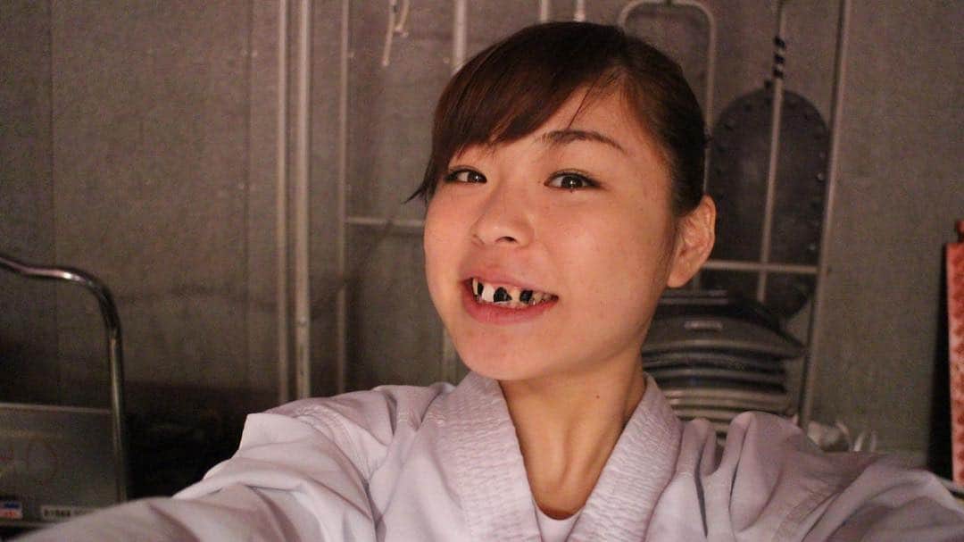植草歩さんのインスタグラム写真 - (植草歩Instagram)「また歯欠けた🤪🤪🤪」4月10日 21時44分 - ayayumin0725