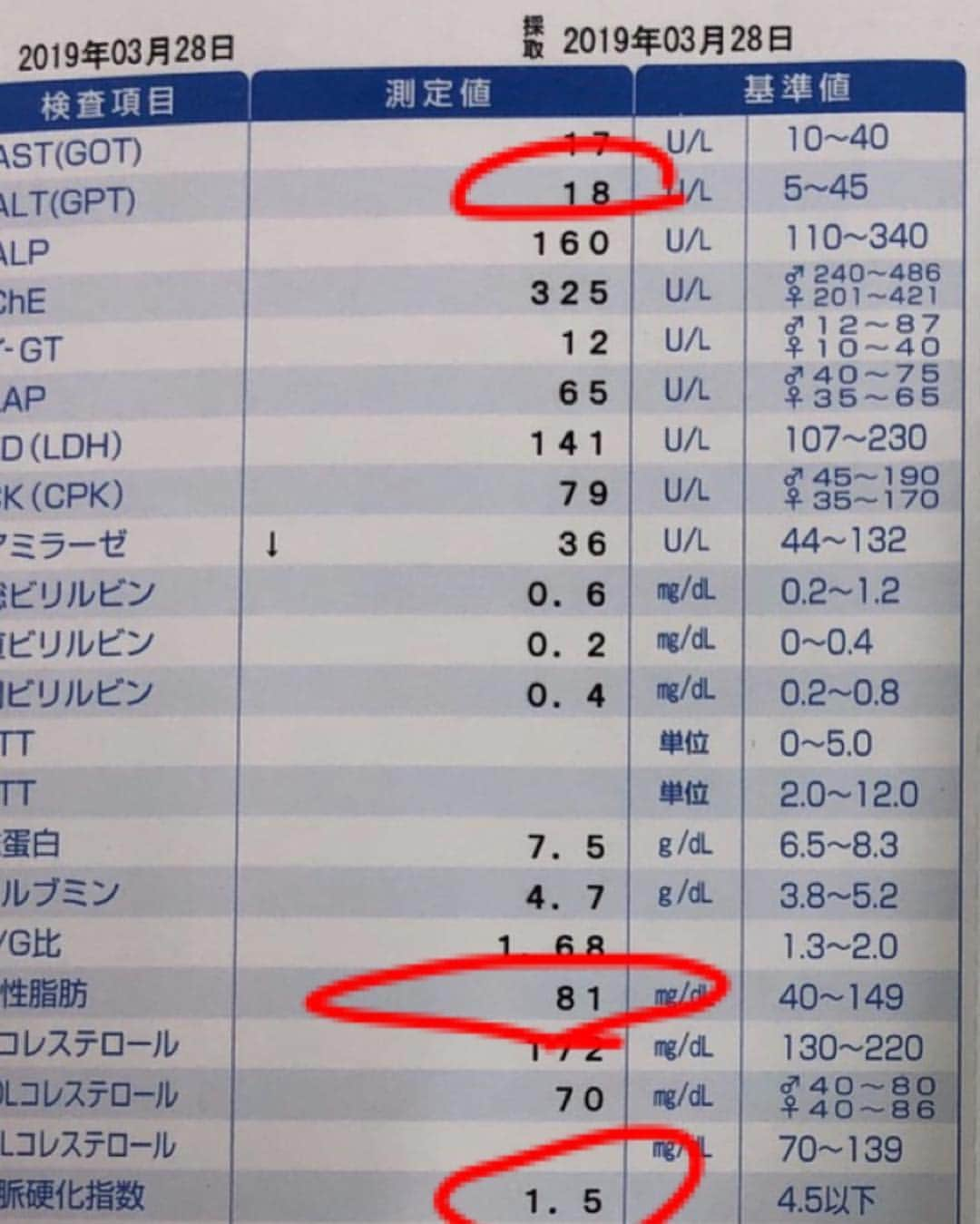 ガリガリガリクソンさんのインスタグラム写真 - (ガリガリガリクソンInstagram)「劇的ビフォーアフター」4月10日 15時57分 - gg_galixon