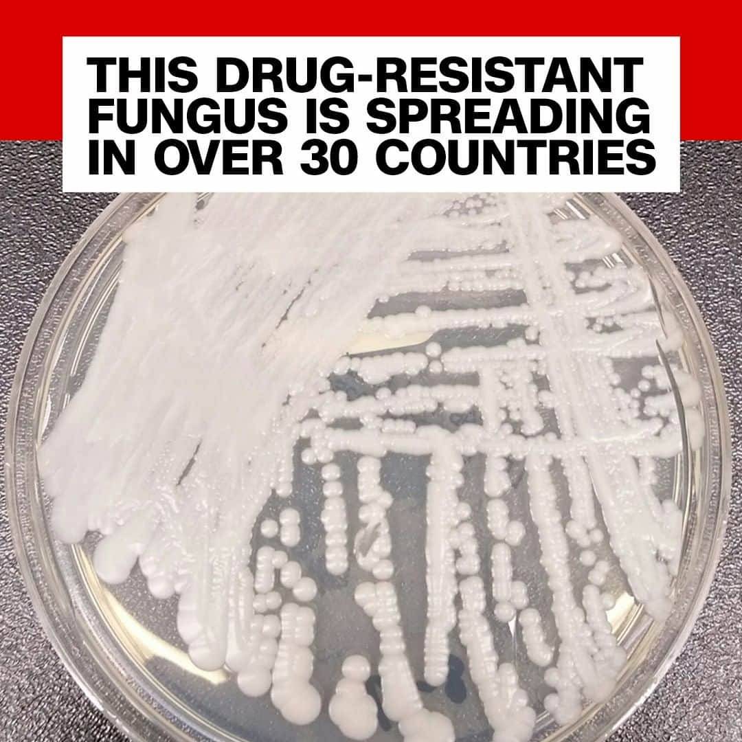 CNNさんのインスタグラム写真 - (CNNInstagram)「Serious cases of Candida auris infections have been reported in more than 30 countries, including the US, Australia, Germany, and India. The drug-resistant fungus is difficult to diagnose and treat, and typically spreads in hospitals or other health care facilities. "It's a bit of a paradox, really," said Dr. David Eyre, an infectious disease physician based at Oxford University. "Why has it suddenly come to cause a problem at a similar time in different parts of the world?" The Centers for Disease Control and prevention estimate that some 30%-60% of people with C. auris infections have died. (📸: US Centers for Disease Control and Prevention)」4月14日 9時51分 - cnn