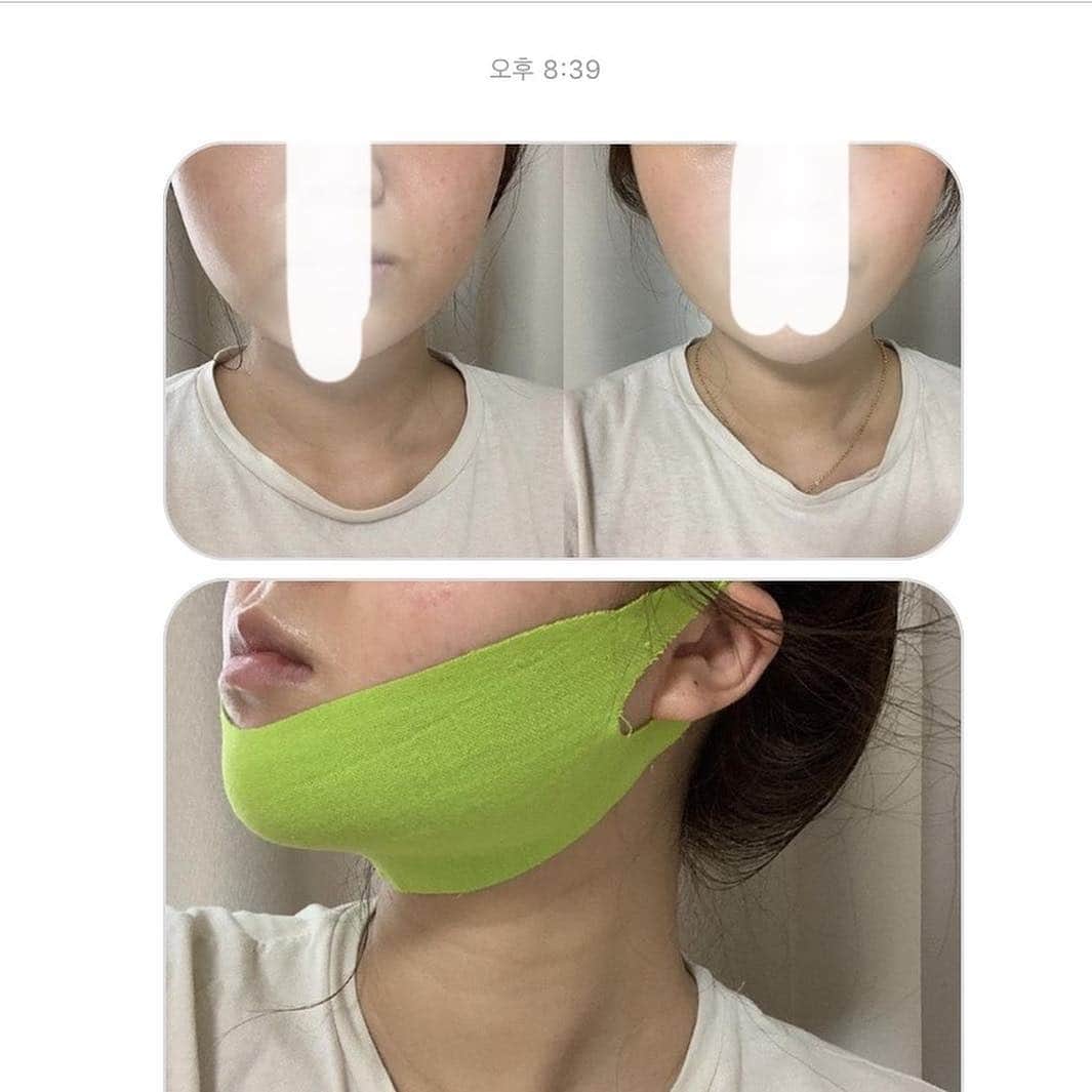 ダユンさんのインスタグラム写真 - (ダユンInstagram)「Hi , do you guys remember the SKEDERM LIFTING BAND ? I uploaded some photos and videos with Mini Shurink (SKEDERM TOUCH WAVE) and this SKEDERM LIFTING BAND! Finally! here is the chance for you to buy SKEDERM LIFTING BAND at 30% discounted price!! You can buy the SKEDERM LIFTING BAND at deeply discounted price from the my Instagram profile link from 15 to 17 April!  คุณสามารถซื้อ SKEDERM LIFTING BAND ในราคาลดพิเศษจากโปรไฟล์ Instagram ของฉันระหว่างวันที่ 15 ถึง 17 เมษายน  In fact, it is a little expensive, I used to wear it only on special day such as shooting day.  You know, I gotta take care of my facial lifting and swelling V line lifting several times more than others, because I had facial contouring surgery.  I’ve been used super many kinds of cosmetics for lifting. But SKEDERM LIFTING BAND, it is the only one thing that has a visible effect for me.  SKEDERM LIFTING BAND is also produced by the company that developed Shurink. When I used the Mini Shurink (SKEDERM TOUCH WAVE), I was so satisfied and experienced a new world, expectedly, this SKEDERM LIFTING BAND is awesome!  I and my friends’s long  have been used it all type of SKEDERM’s lifting mask(SKEDERM LIFTING PATCH and SKEDERM LIFTING BAND) for long time. As the result, SKEDERM LIFTING BAND is the lit!  If your face swells easily, you would love it!  As my make up video I uploaded before, I was wearing it while I was doing my hair. I got visible effect after using it for only 40 mins.  So, a lot of people from every countrie asked me what the band is. So then, I thought I should review it after using it steadily for a while. After using it for few months, VERY SATISFIED!  I have been using it steadily for few months even before I held group shopping event for Mini Shurink (TOUCH WAVE). And isn’t it better to buy it cheaply than to buy it at original price!  Normally I wear SKEDERM LIFTING BAND after shower and skincare and go to bed  before special event. Or wear it before doing hair and make up in the morning. It relieves swelling on the face because it has cooling down effect even you don’t put it into refrigerator.  If you stretch it sufficiently before you wear it, your ears will hurt less.」4月15日 18時01分 - 2__yun__2
