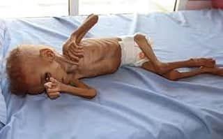 トーマス・サドスキーさんのインスタグラム写真 - (トーマス・サドスキーInstagram)「85,000 CHILDREN have starved to death because of the entirely man-made famine in Yemen. More than 5 million more children are on the brink (over 20 million people total). Additionally, a cholera epidemic is imminent. And there aren’t enough votes in the GOP-controlled Senate to overturn Trump’s veto of the resolution to end US involvement and support for the Saudi-lead coalition responsible for this all. The new GOP isn’t pro-life, they are pro-power.  To help:  NGOs • @docrorswithoutborders • @savethechildren • @theirc  Local: • Baitulmaal AHED provides food, clothing and medical supplies. • Islamic Relief USA delivers food, clothing and medical supplies and provides health screening, farming support and business training. • And the Zakat Foundation of America works through partnerships to provide food and water. The organization has also helped fund and train hundreds of local farmers.」4月17日 22時27分 - thomas_sadoski