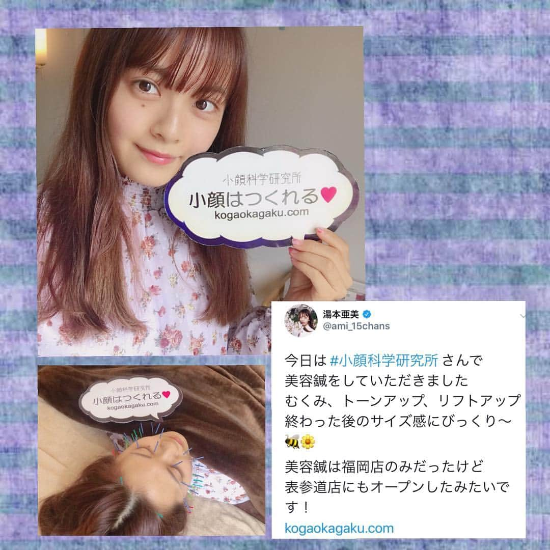 小顔科学研究所 さんのインスタグラム写真 - (小顔科学研究所 Instagram)「AKB48の湯本亜美様がご来店下さいました★﻿ ﻿ ﻿ 今回は初の美容鍼を受けに来て下さりました🎶﻿ 小顔科学研究所では美容鍼が﻿ 福岡天神院に続き、大阪、東京でも﻿ 施術を受けて頂けるようになりました(^ ^)🌟﻿ ﻿ むくみが出にくいタイプだと﻿ おっしゃっていましたが、﻿ 施術後はむくみがスッキリして、﻿ お顔もひと回りサイズダウンしました🎶﻿ サイズ計測でとてもびっくりされていました🧸 ﻿ またのご来店お待ちしております✨﻿ ﻿ Instagram DMからもお問い合わせ可能です★﻿﻿﻿﻿﻿﻿﻿﻿﻿ ﻿﻿﻿﻿﻿﻿﻿﻿﻿ ぜひ、お待ちしてます☀﻿﻿﻿﻿﻿﻿﻿﻿﻿ ﻿﻿ .﻿﻿﻿ ┈┈┈┈┈┈┈┈┈┈┈┈┈┈┈┈┈┈﻿﻿﻿﻿﻿﻿﻿﻿﻿﻿﻿ ﻿﻿﻿﻿﻿ ﻿﻿﻿ ﻿﻿﻿ #湯本亜美 #AKB48  #小顔 #小顔矯正 #骨盤矯正 #小顔科学研究所 #痛くない小顔矯正 #小顔サロン #小顔効果 #小顔はつくれる #芸能人御用達 #美容 #整体 #美容整体 #無痛矯正 #顔の歪み #むくみ #たるみ #東京 #表参道 #名古屋 #栄 #大阪 #心斎橋 #福岡 #天神 #smallerface #treatment #beauty」5月3日 14時29分 - kogaokagaku