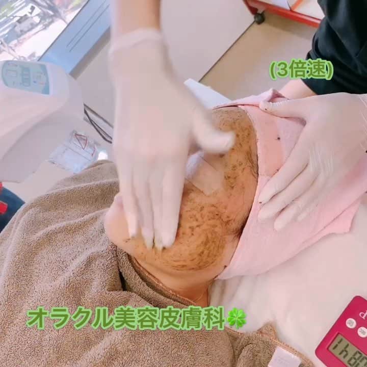 オラクル美容皮膚科東京新宿院のインスタグラム
