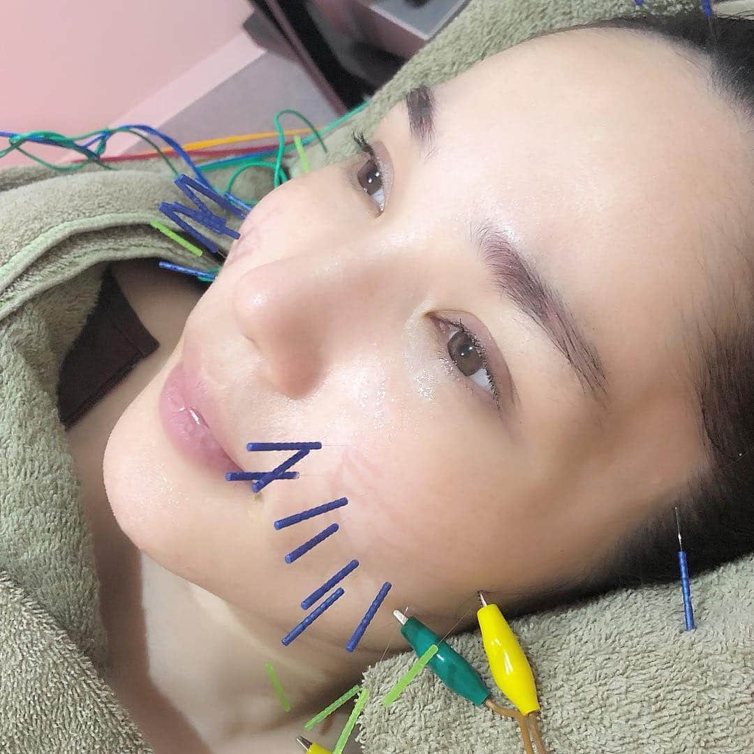 平野ノラさんのインスタグラム写真 - (平野ノラInstagram)「蘇った🧖🏻‍♀️✨✨ ハリッチのスタッフさんの肌はいつみても綺麗！ 底から潤ってる！説得力が違う！納得の美容鍼だゾ✨✨✨ #新宿 #ハリッチ #針治療 #小高院長  #武士先生 #メンテナンス #蘇る #スタッフさんの肌 #ゲロマブ #平野ノラ #okバブリー」4月20日 11時21分 - noranoranora1988