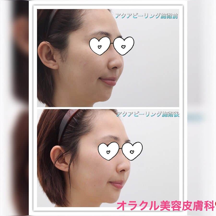 オラクル美容皮膚科東京新宿院のインスタグラム