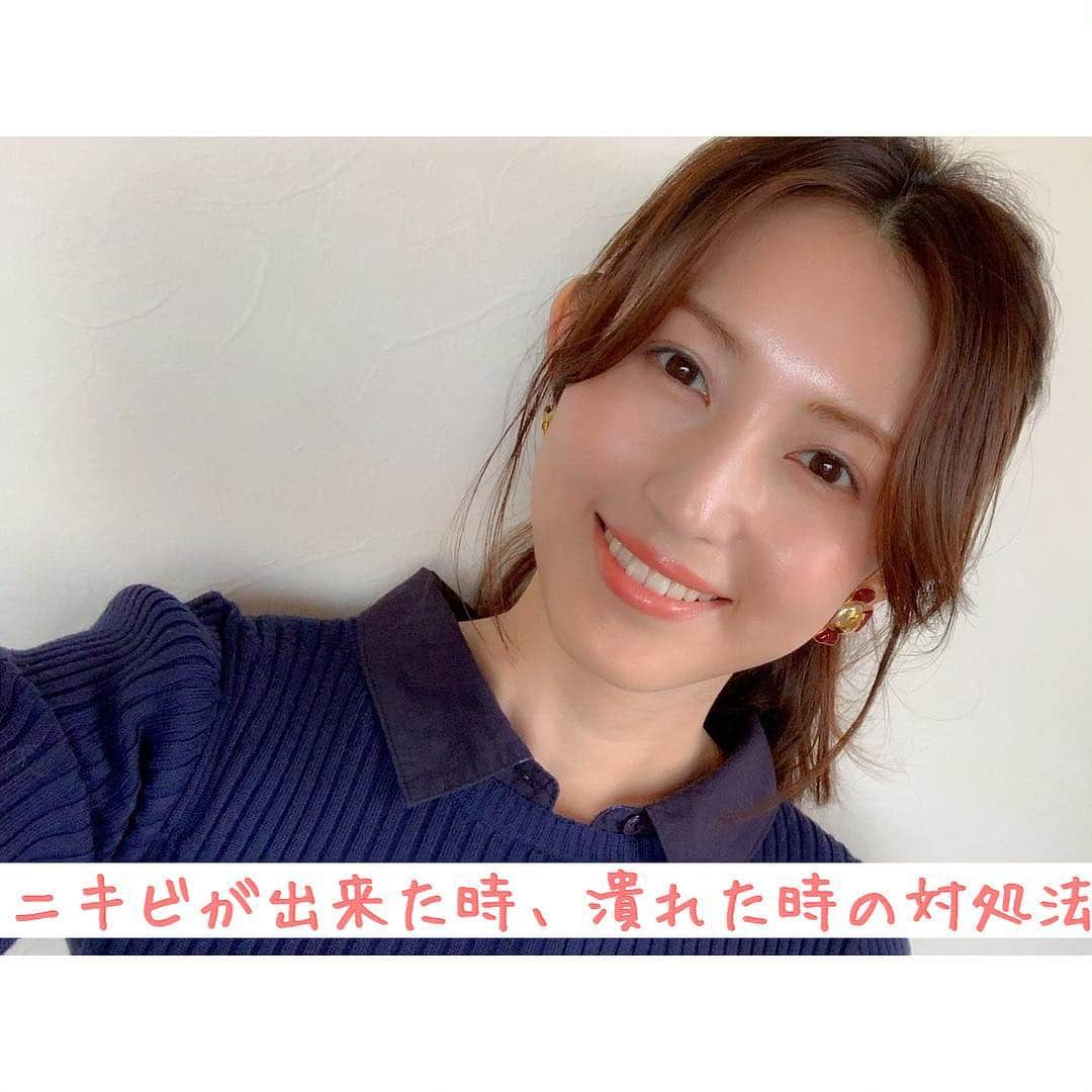 有村実樹さんのインスタグラム写真 - (有村実樹Instagram)「💥💄💥﻿ ニキビが出来た時、潰れた時の対処法❣️﻿ ﻿ ﻿ しばらく芯のある感じで成長を停止していたニキビがあったのですが、体の疲労のせいか？一気に成長して昨夜潰れました😵﻿ ﻿ 少し長くなりますが、ニキビに悩む方も多いと思うので、、﻿ ﻿ 今日はニキビができているとき、潰れたときの対処法をご紹介します。﻿ ﻿ ﻿ ﻿ 💛ニキビが出来たとき﻿ 上からメイクをするのは負担になるので、ニキビが出来ているときはニキビパッチなどのシールで保護するのがオススメ。﻿ 韓国製のものが人気で沢山種類もありますが、今回私は、いざという時のために以前から買っておいた<はるコスメ>を使用しましたよ。(写真2.3枚目の左)﻿ 貼ることで赤みが一段薄くなりますし、その上からコンシーラー&パウダーファンデで赤みは綺麗に隠れます。﻿ 口周りの皮膚の動きが大きいところなので、ちょっとシワが寄ってしまいましたが、ぱっと見隠れていれば🆗かな😊﻿ ﻿ ﻿ ﻿ 💚ニキビが潰れたとき﻿ (昨日から以下の方法で対処しました。)﻿ ﻿ 潰れたニキビはもはや傷と同じなので、キズパワーパッドのようなハイドロコロイド素材で保護しつつ湿潤療法で傷を治します。﻿ 私は自分の好きなサイズに切って使える<ズイコウ ハイドロコロイド包帯>を愛用していますよ。﻿ 紫外線もカットしてくれるので、傷痕が残りにくくなります。﻿ 写真6枚目のように、1センチ角にカットして一晩貼るだけでも傷表面が綺麗に整うので、透明の体液が傷口から出なくなったら、また<はるコスメ>などのニキビシールを貼って完璧に治るまで保護しましょう♪﻿ ﻿ ﻿ ﻿ ちなみに、﻿ 写真2枚目3枚目で紹介している、<はるコスメ>は、ニキビを治す成分は配合されていない、傷を保護するシールです。﻿ ニキビパッチと検索すると、ニキビの炎症を抑える美容成分が配合されたものも沢山出ているので、気になるものを試してみてくださいね。﻿ ﻿ ﻿ ニキビ痕やシミ用の<シミ隠しシート>は、肌色がプリントされた傷跡やシミを隠す専用のシートです。﻿ まだ傷状態の時には、使用は避けましょう。﻿ ﻿ ﻿ ﻿ ニキビが出来ても、正しく対処すればニキビ痕は防げます♪﻿ いざという時にはぜひ試してみてくださいね😉﻿ ﻿ ﻿ ﻿ ﻿ #beauty #miki_cosmetics_list #ニキビ #ニキビ痕 #吹き出物 #大人ニキビ #ニキビパッチ #はるコスメ #ハイドロコロイド包帯 #ハイドロコロイド #傷 #肌荒れ #美肌 #美容 #miki_beauty_movie_ニキビ」4月20日 16時47分 - arimura_miki