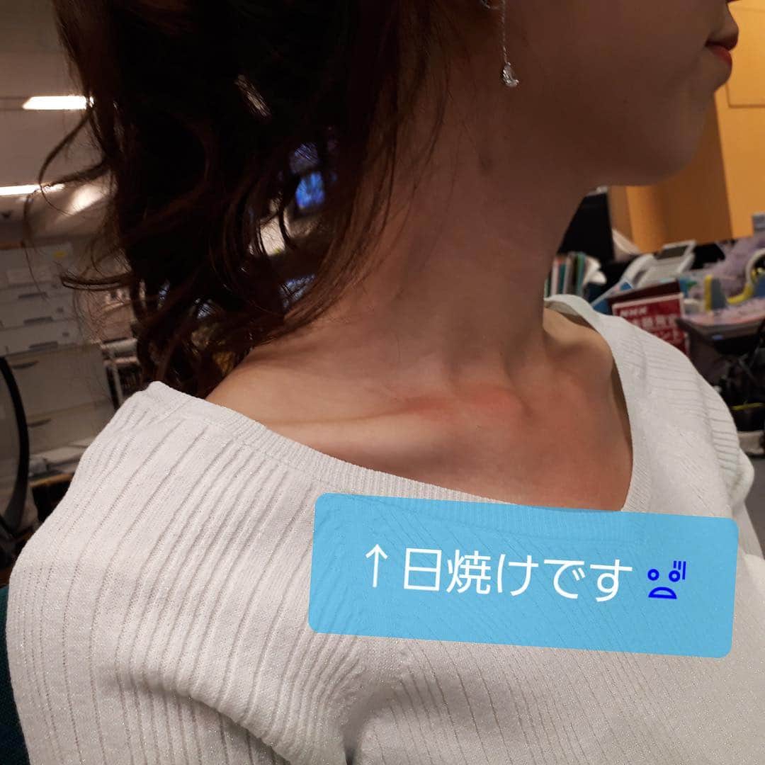 フジテレビ「プライムニュース イブニング」さんのインスタグラム写真 - (フジテレビ「プライムニュース イブニング」Instagram)「きょうの衣装はグリーン🍀。﻿ 濃いグリーンの竹内アナ 薄いグリーンの内田アナ。﻿ 白っぽいけど薄いグリーンなんですよ👀。﻿ 番組がスタートして半月が過ぎました あっという間です😳😳。﻿ ﻿ そして、昨日から今日の﻿ 内田アナの移動距離が半端ない‼️﻿ 取材の為の昨夜から広島入り。﻿ 朝からアーバンスポーツの祭典を取材。﻿ 昼過ぎには、『Live News it!』の出演に向け、﻿ 広島を出発。﻿ そして、番組に出演❗️﻿ ﻿ 半端ない‼️移動距離ですが、本人は超元気💪💪。﻿ ただ、紫外線対策が甘かった…。﻿ 鎖骨部分が日焼け、残念😝。﻿ ﻿ #アーバンスポーツ﻿ #fise﻿ #日焼けに注意﻿ #半端ない﻿ ﻿ #竹内友佳﻿ トップス スカート #indivi @indivi.official ﻿ #sunauna @sunauna.official﻿ #野島卓﻿ ネクタイ #フェアファックス @fairfaxtokyo﻿ #内田嶺衣奈 @reina.uchida﻿ トップス スカート #rope @rope_jp﻿ ﻿ #加藤綾子 #風間晋 #木村拓也 #酒井千佳 #荘口彰久 #副島淳 #福原直英 #佐々木恭子 #小澤陽子 #海老原優香 #安宅晃樹 ﻿ #フジテレビ #アナウンサー #livenews_it」4月21日 21時19分 - livenews_it