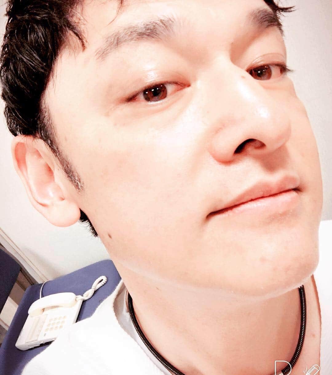 宮田麺児のインスタグラム：「‪つるつる。水晶。クリスタル肌。 ありがとうゴリちゃん ‪#ゴリラクリニック‬ ‪#髭脱毛‬ ‪#美肌‬」